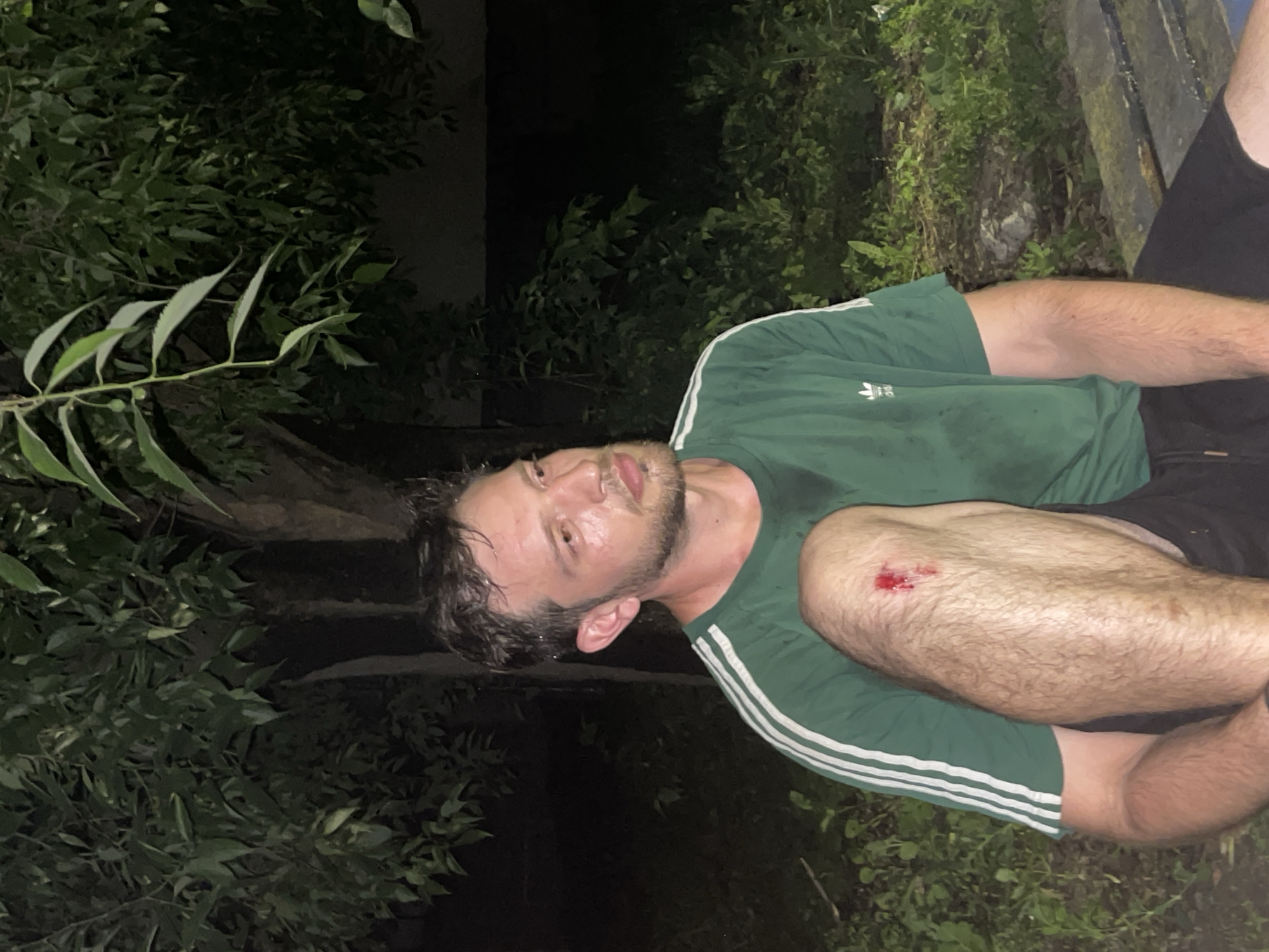The image features a man, likely in his 20s or 30s, with a beard and short, wet dark hair, looking directly at the viewer. He is wearing a dark green t-shirt with white stripes on the sleeves and the Adidas trefoil logo on the chest, along with dark shorts. A fresh, bloody scrape is visible on his right knee. The man is positioned horizontally across the frame, suggesting he is lying down or leaning back.
The setting is outdoors, characterized by dense, dark green foliage from trees and bushes that fill the background and portions of the foreground. The overall lighting is dim, indicating that the photo was taken at night or in a very dark environment. A subtle hint of a wooden or concrete structure can be seen partially behind his right leg. The man's expression is relatively neutral, suggesting he is aware of being photographed despite the visible injury. His wet hair and the knee wound might imply a recent fall or physical exertion.