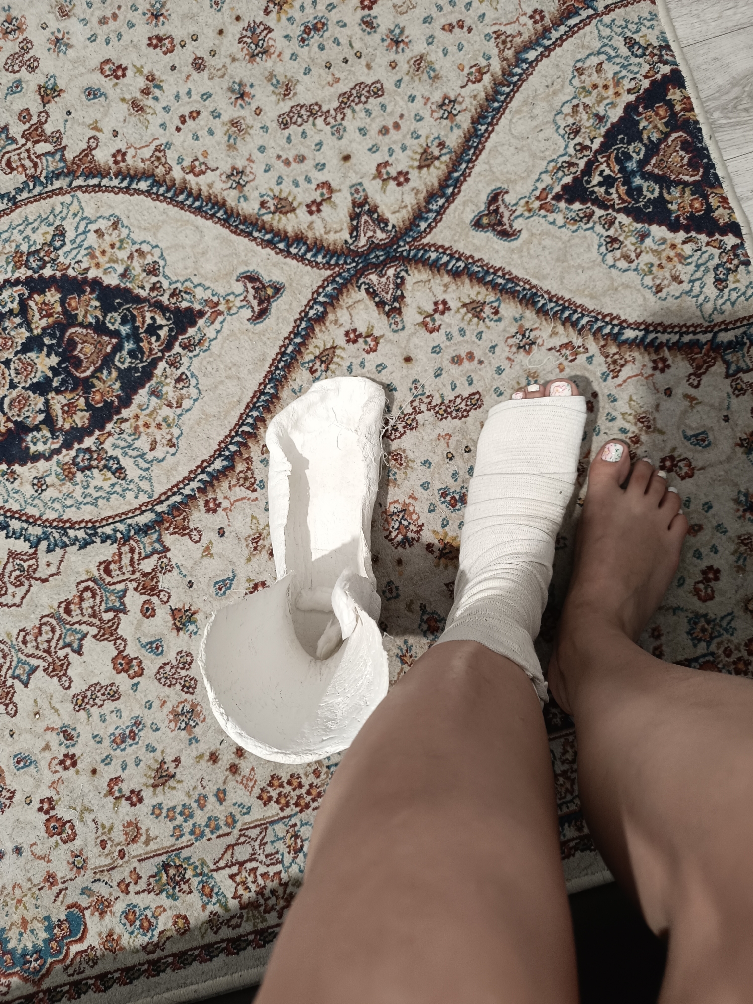 The image shows a person's legs and feet lying on a patterned rug. One foot is wrapped in a white bandage, and the other is bare with painted toenails featuring a floral design. Next to the bandaged leg lies a broken white plaster cast. The rug has a complex design with cream, blue, red, and brown colors. The lighting suggests it might be daytime, with sunlight casting shadows. The scene appears to be indoors, possibly in a home setting. There is no visible text in the image.