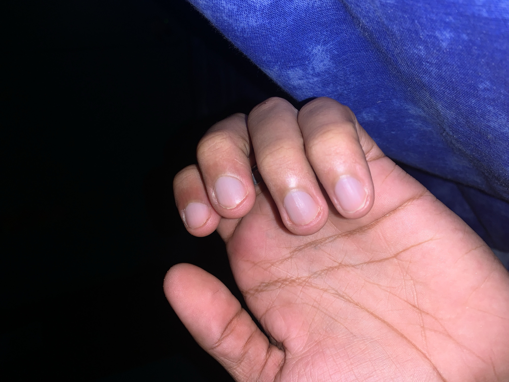 A person's right hand is prominently featured in the foreground of this dimly lit image. The hand has a medium brown skin tone, with fingers gently curled. The palm faces upwards and slightly inwards, displaying distinct palmar lines. All five fingernails are visible, appearing clean, relatively short, and healthy, with a clear view of the pale lunulae at their bases.
The background on the left side of the image is completely dark, suggesting either a very dark room or nighttime conditions. The upper and right portions of the background are occupied by a blue, textured fabric, possibly denim or a similar woven material, which shows some variations in shade and texture. The hand appears to be resting or lightly gripping the edge of this fabric.
No specific activity is taking place other than the pose of the hand. No facial expressions or body language are visible to convey emotions. There are no identifiable location cues within the image itself, though the context provided specifies Santa Ana, Venezuela. No visible text is present in the media. The overall impression is a close-up, somewhat intimate shot of a hand in a low-light environment.