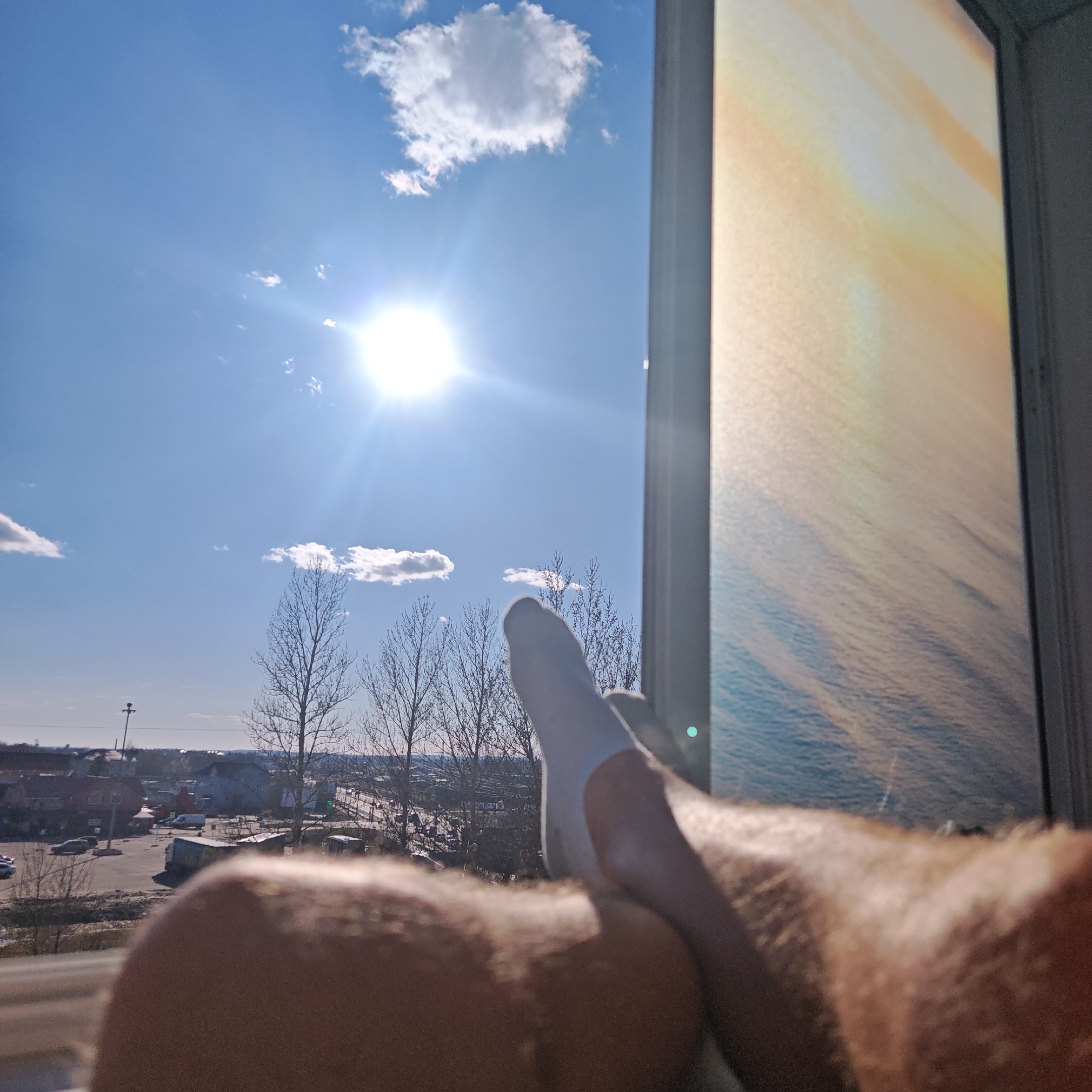 A sunny cityscape view is framed by a window, possibly from a high-rise building in Rostov, Russia. In the foreground, a person is partially visible, with hairy legs and a toe covered in a white bandage, obscuring some of the cityscape. The exterior view is dominated by a bright blue sky with scattered clouds and a strong sun. Bare trees stand in the middle ground, while a road and buildings stretch out in the distance, characteristic of a city landscape. To the right, the edge of a screen or window frame displays a blurred image suggesting water and light.