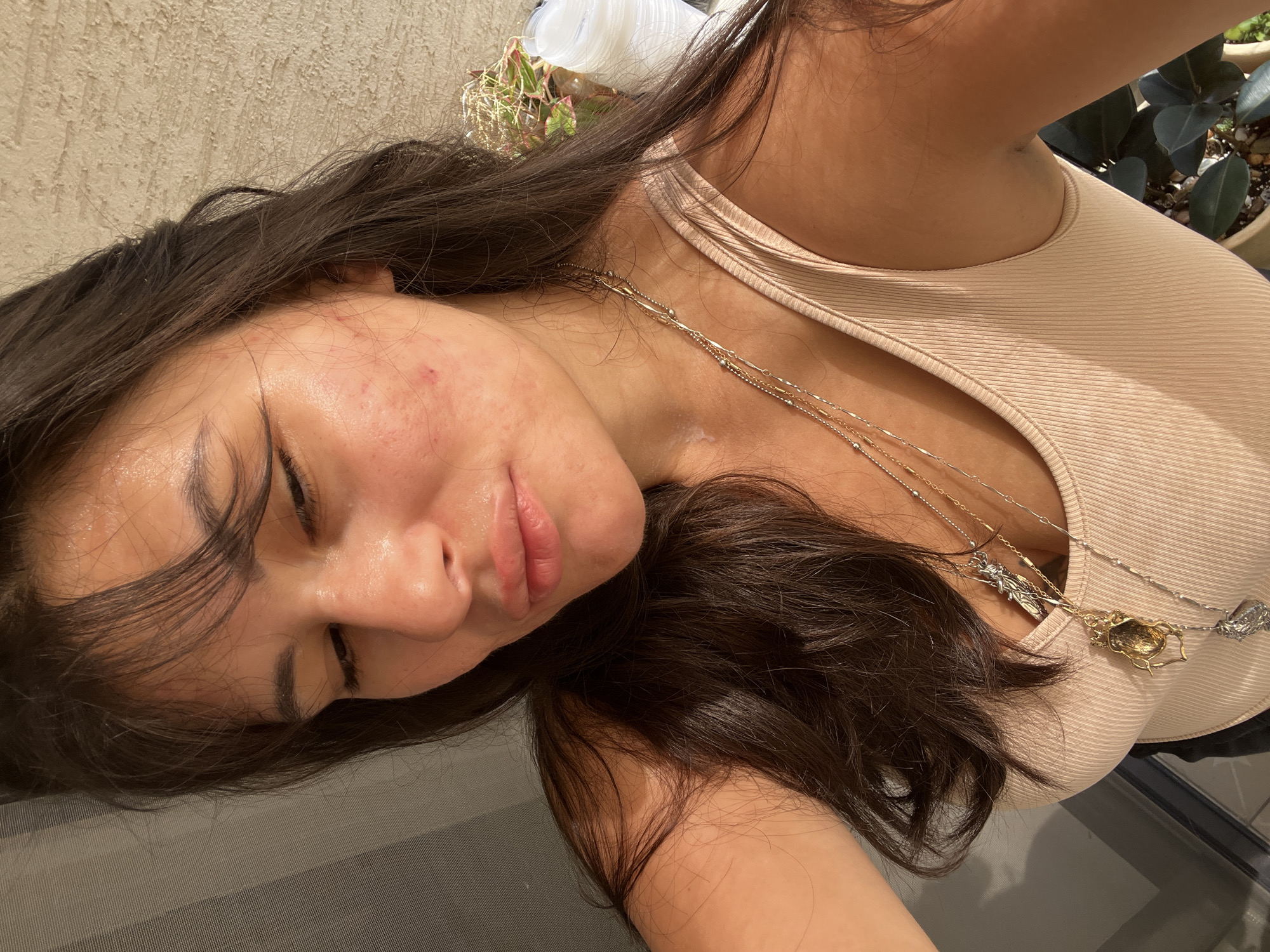 A medium shot shows a woman with dark hair and a light complexion, looking downwards. She is wearing a nude-colored tank top and multiple layered necklaces. Her face shows some redness and blemishes, particularly on her cheeks. The background is blurred and appears to be an outdoor setting with a textured wall and some greenery. The woman's hair is dark brown and falls around her shoulders and chest. The lighting suggests it might be late afternoon or early evening. There is no indication of the city of Kiryat Bialik, Israel.