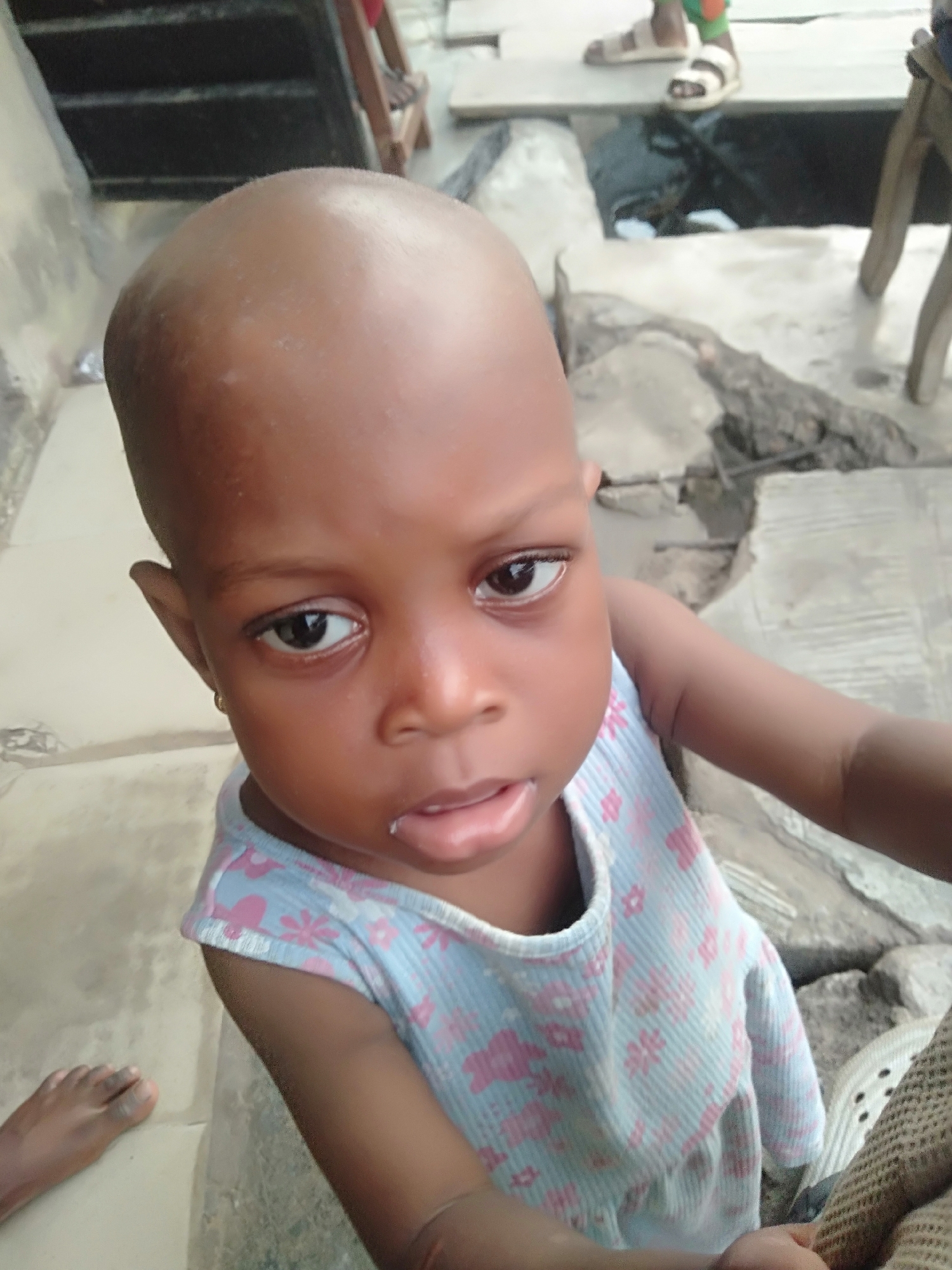 A young, bald-headed child with dark skin is the primary subject of this eye-level, outdoor shot. The child is wearing a light blue top with pink floral patterns and is looking directly at the camera. The background includes a gray, weathered concrete surface with visible cracks and uneven textures. Other elements in the scene include a partially visible foot on the left side of the frame and some furniture in the background. The exact location is unspecified.