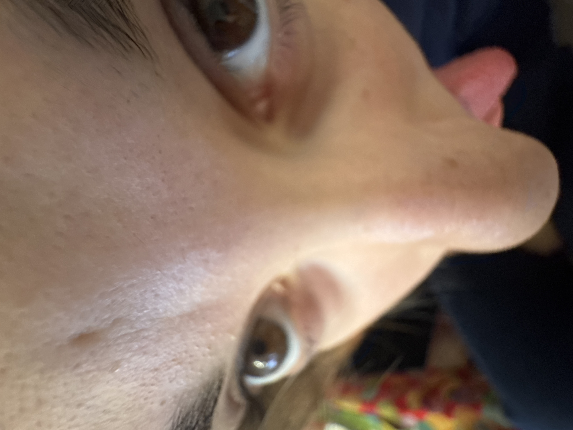 The image shows a close-up view of a person's face, angled from below. The nose is prominent, extending towards the top right of the frame. Two brown eyes are visible, one near the top left and the other near the bottom center. Skin texture, including pores and a small mole, are visible on the cheek. The environment appears to be indoors, with a blurred pattern visible in the background. The scene does not contain any information to specify its location is in Varna, Bulgaria.
