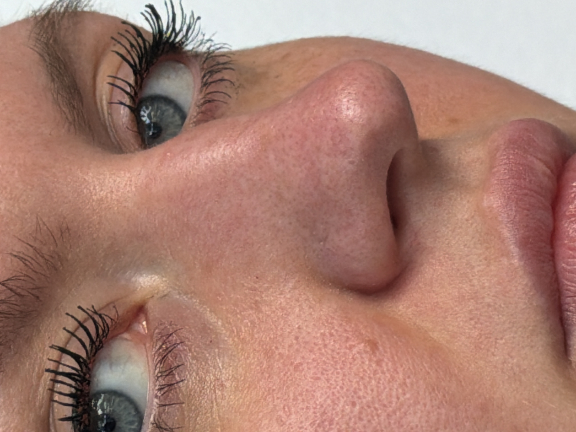 The image presents a close-up, angled view of a person's face, likely a woman, against a plain, light background. The subject is seen from a side-profile perspective, emphasizing the right eye, nose, and upper lip, with a portion of the left eye also visible in the lower left corner.
The right eye has a blue-grey iris, a clear sclera, and natural-looking eyebrows. The eyelashes are long and appear to be coated with dark mascara. The skin across the nose and cheek area exhibits visible pores and a generally even tone with some minor redness and texture variations. The nose is prominent in the frame. The visible part of the upper lip appears full and a natural pinkish hue.
There is no clear activity or event taking place; the subject's expression appears neutral. The lighting is bright and even, highlighting facial details. No specific location cues, time of day, or weather details are discernible within the image. No text is visible. While the image itself does not provide specific location cues, it is contextually associated with Kumluca, Turkey.
