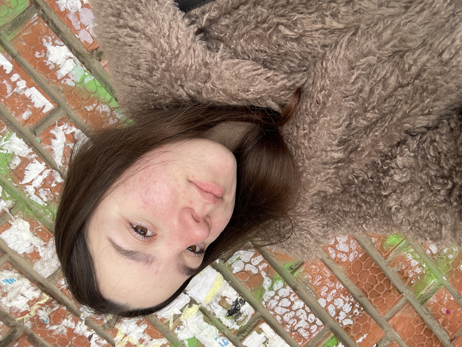 A close-up, angled portrait features a young female individual positioned outdoors against a brick wall. The subject has long, dark brown hair and light brown eyes, with visible eyelashes. Her skin exhibits areas of redness and minor blemishes on the cheeks and nose. She is wearing a thick, textured coat or jacket made of a curly, light brown or beige material. The background is a red-orange brick wall, partially covered with irregular, faded patches of white and some green paint or distressed paper fragments, indicating an aged surface typical of an exterior urban setting. The specific location in the city of Ольховка, Russia, is not visually discernible from the image itself.