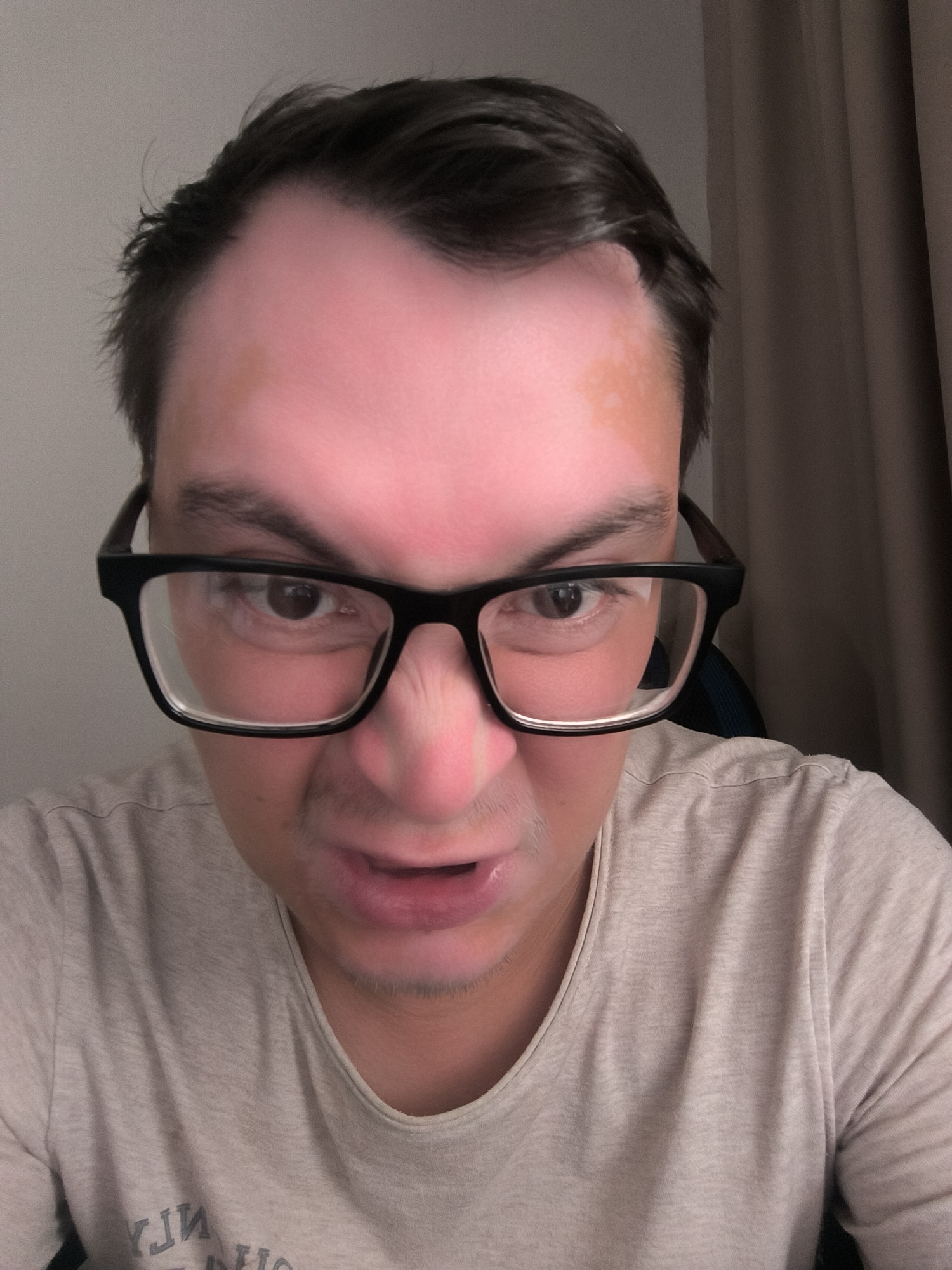 The image shows a close-up, low-angle selfie of a person wearing glasses. The person has dark hair and appears to be looking directly at the camera with a stern or angry expression, their mouth slightly open. Their forehead is visibly flushed pink, with lighter patches on the temples. They are wearing a light-colored t-shirt. The background is blurred, with a wall to the left and a brown curtain to the right, suggesting an indoor setting, possibly a room. The lighting appears to be artificial, casting shadows and highlighting the contours of the face. No specific time of day or weather conditions are discernible, and there are no obvious location cues beyond the provided context of Kovrov, Russia. The image captures a moment of intense emotion or a staged grimace. Visible text is present on the t-shirt, but it is partially obscured and difficult to read clearly.