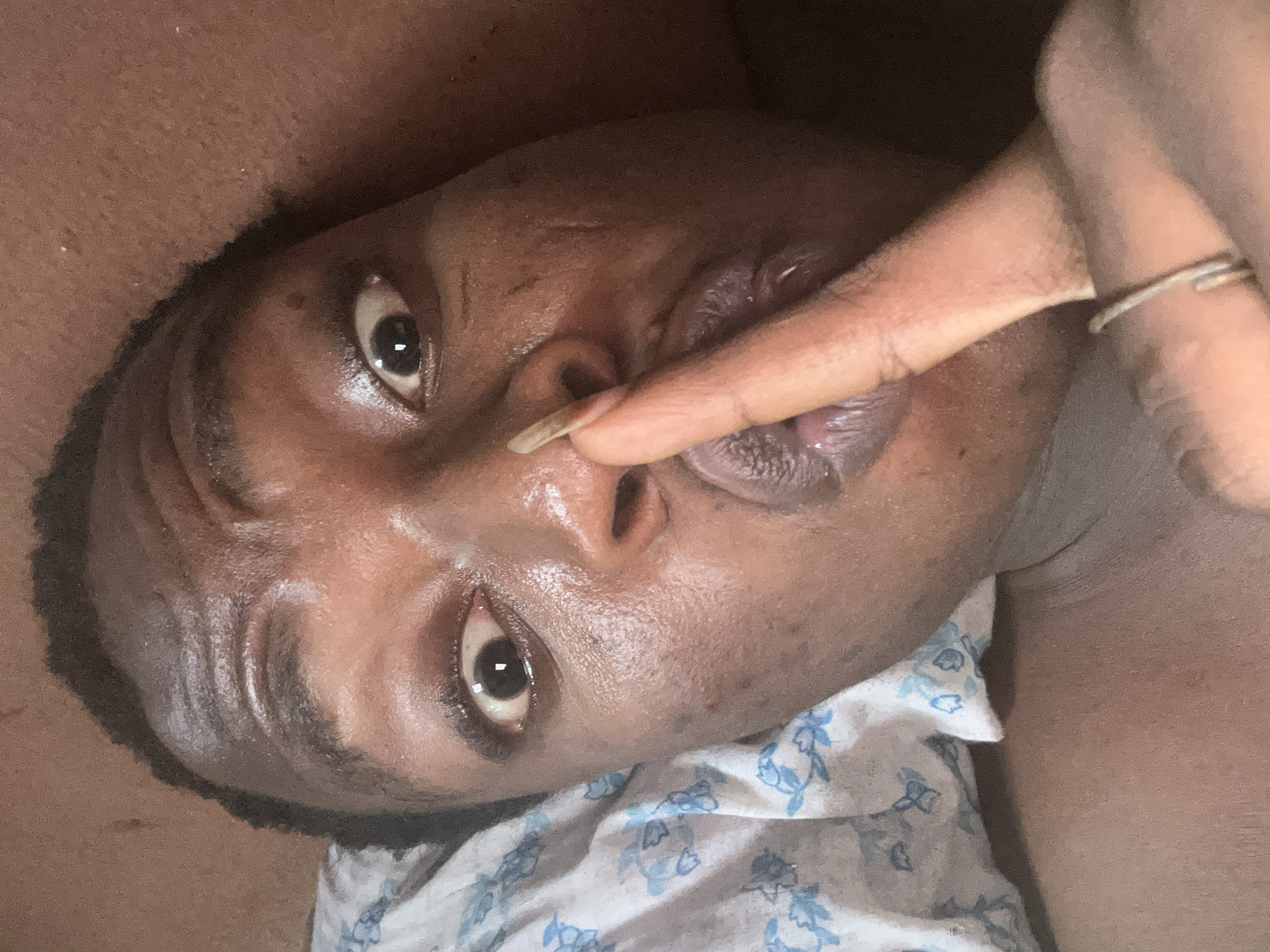 A close-up portrait of a person with dark skin, lying on their side with their head tilted. Their right index finger is pressed against their lips and nose. The person has dark eyebrows, dark eyes with visible reflections, and short dark hair. They are wearing a light-colored garment with a blue floral pattern. A ring is visible on the index finger. The background is plain and indistinct. No information is provided regarding the location in the city of Unknown, Unknown.