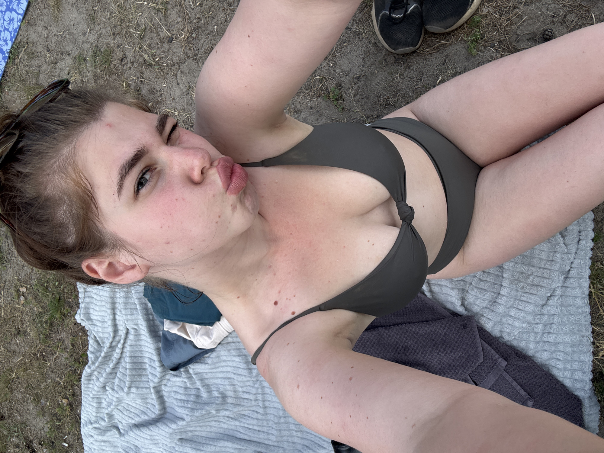 The image shows a young woman lying on a towel on the ground. She is wearing a dark green bikini and has her hair pulled back. The woman is looking at the camera with her lips pursed and is winking. She has several moles on her chest and arm. In the background, there are some shoes and grass. The scene appears to be outdoors during the daytime, possibly at a park or beach. The lighting suggests it is a sunny day.