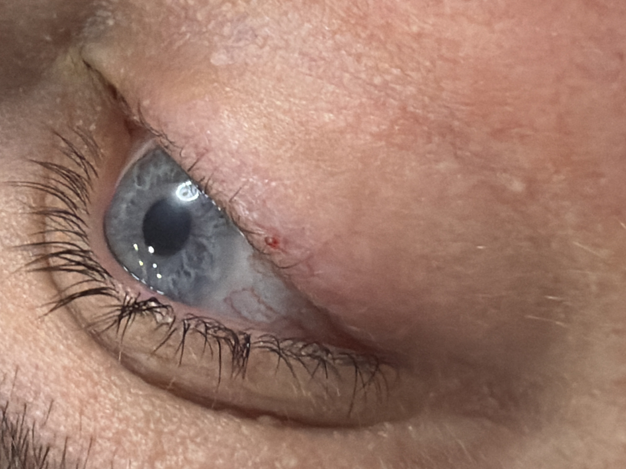 A close-up, eye-level, outdoor shot focuses on a human eye, likely belonging to a female, given the length and thickness of the eyelashes. The iris is a striking blue, with a reflection of what appears to be a light source, possibly a ring light, visible in the pupil. The skin surrounding the eye is fair-complexioned and textured, with visible pores and fine lines. A small, reddish blemish is present on the lower eyelid, close to the inner corner of the eye. The context of Узюково, Russia, is not evident in this image.