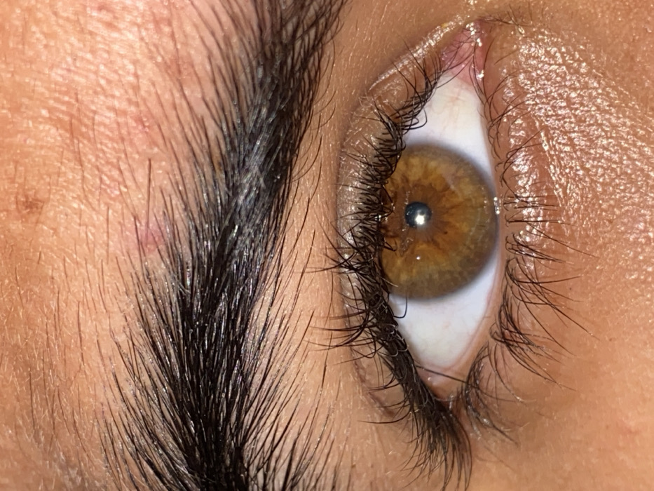 A close-up shot focuses on a right eye with a hazel iris and dark eyelashes. The eye is positioned to the right of the frame, reflecting a light source on its surface. To the left, a thick, dark eyebrow angles upwards. The skin surrounding the eye appears to have small bumps and visible pores, contributing to the natural texture of the image.