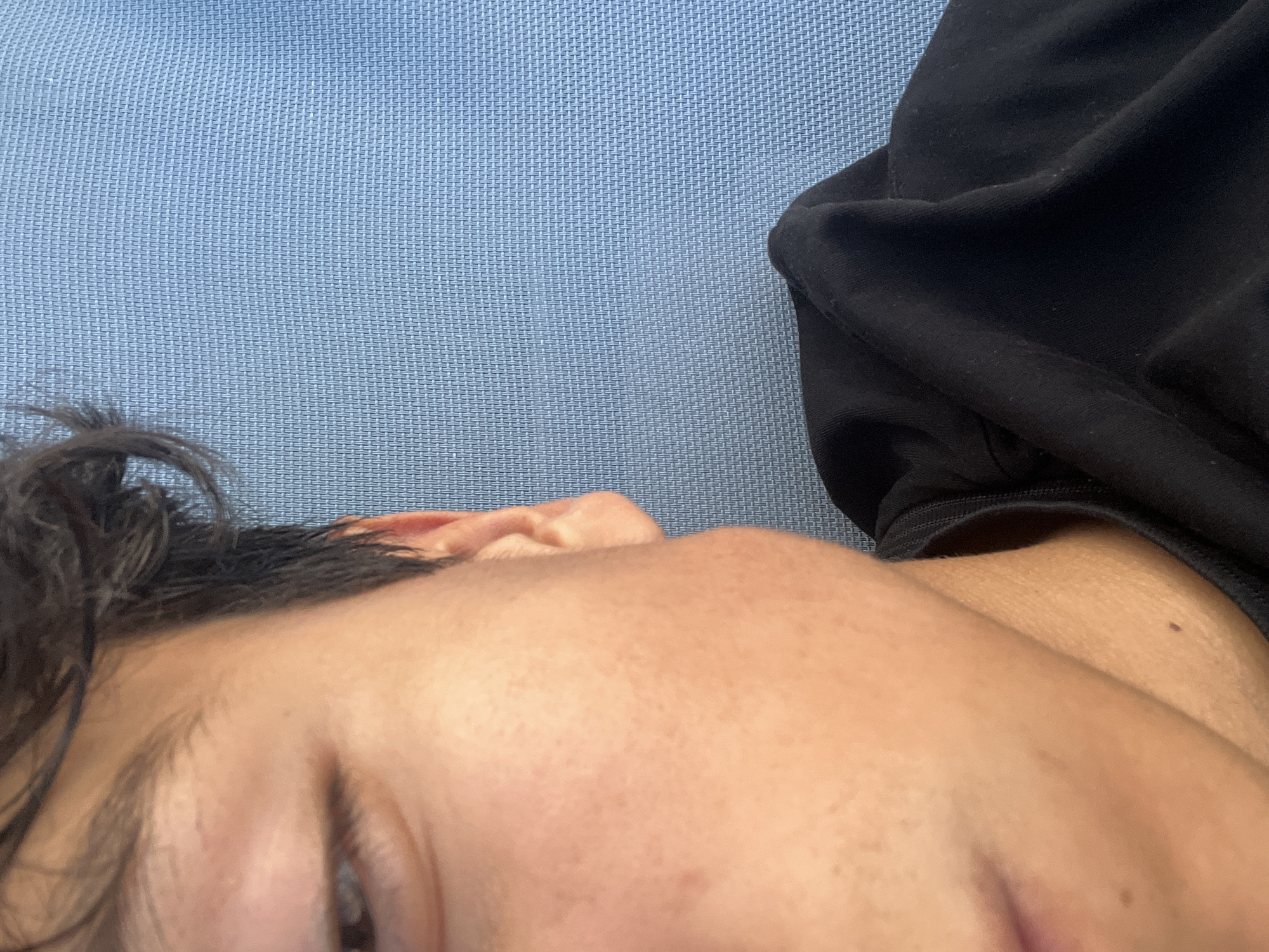 An individual lies on a light blue textured surface, likely fabric. The person is wearing a black garment. The focus is on the right side of their face, including the eye, ear, and temple area. The location is unknown.