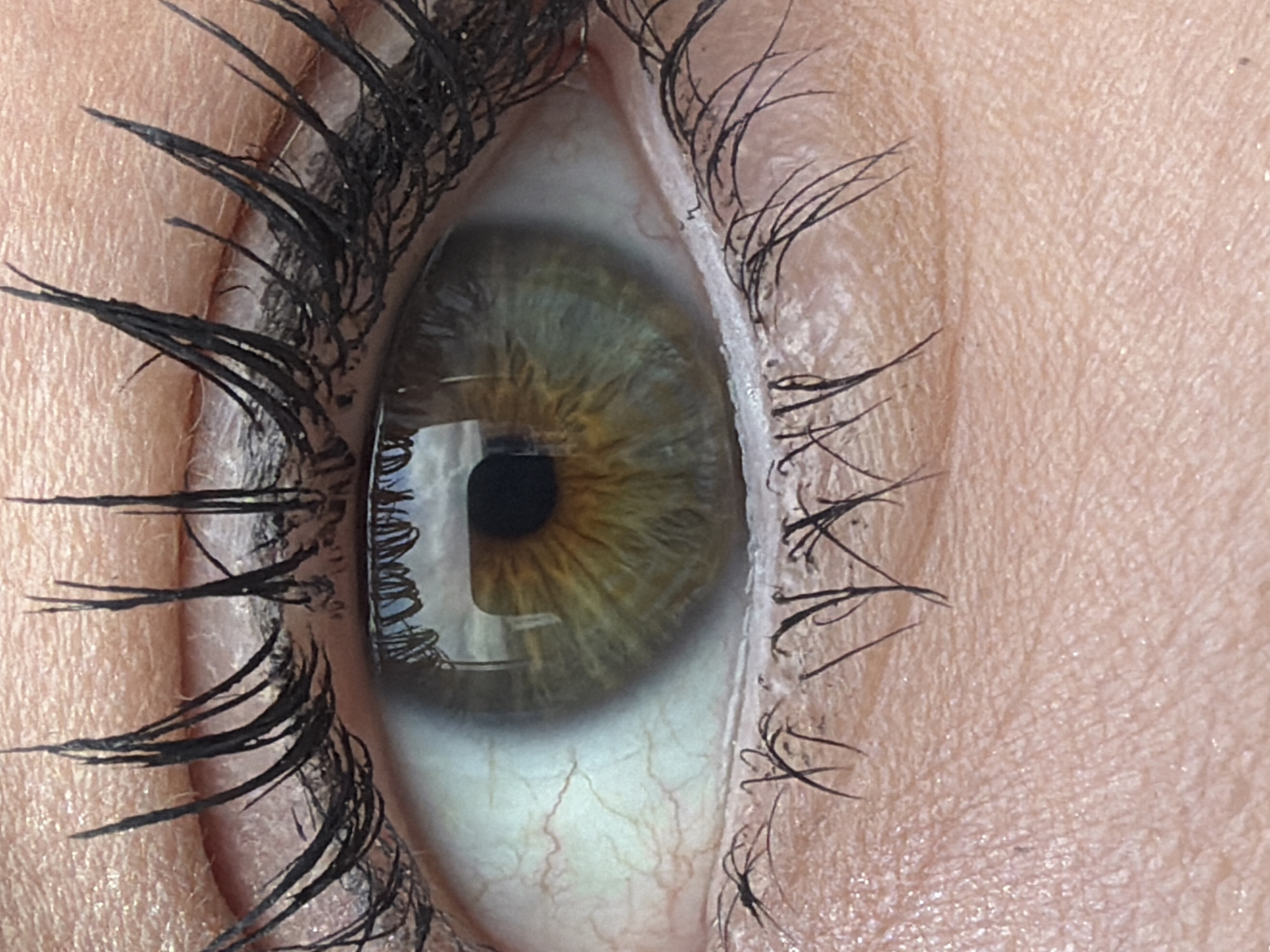 A close-up view of a human eye with hazel-colored iris and heavy black mascara on the upper lashes. The sclera exhibits visible blood vessels. The surrounding skin is light-toned. There is no indication of the location in Murino, Russia in the image.