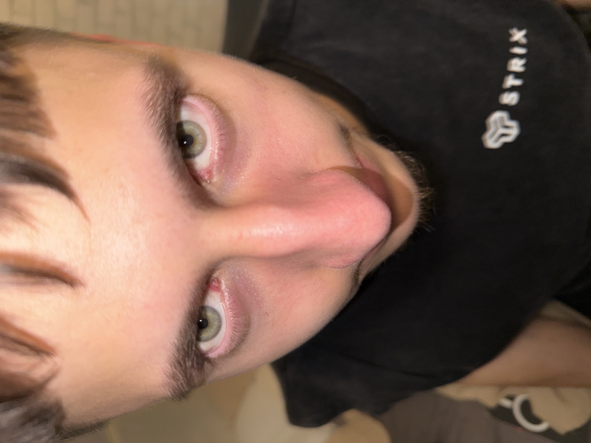 A close-up shot presents a person's face from a low angle, focusing on their eyes, nose, and the upper portion of their face. The individual has light skin, dark hair, and green eyes. The eyes appear slightly red and watery. The person is wearing a black T-shirt with a white "STRIX" logo on the upper right side. The background is blurred and indistinct. There are no indications of the location being Sofia, Bulgaria.