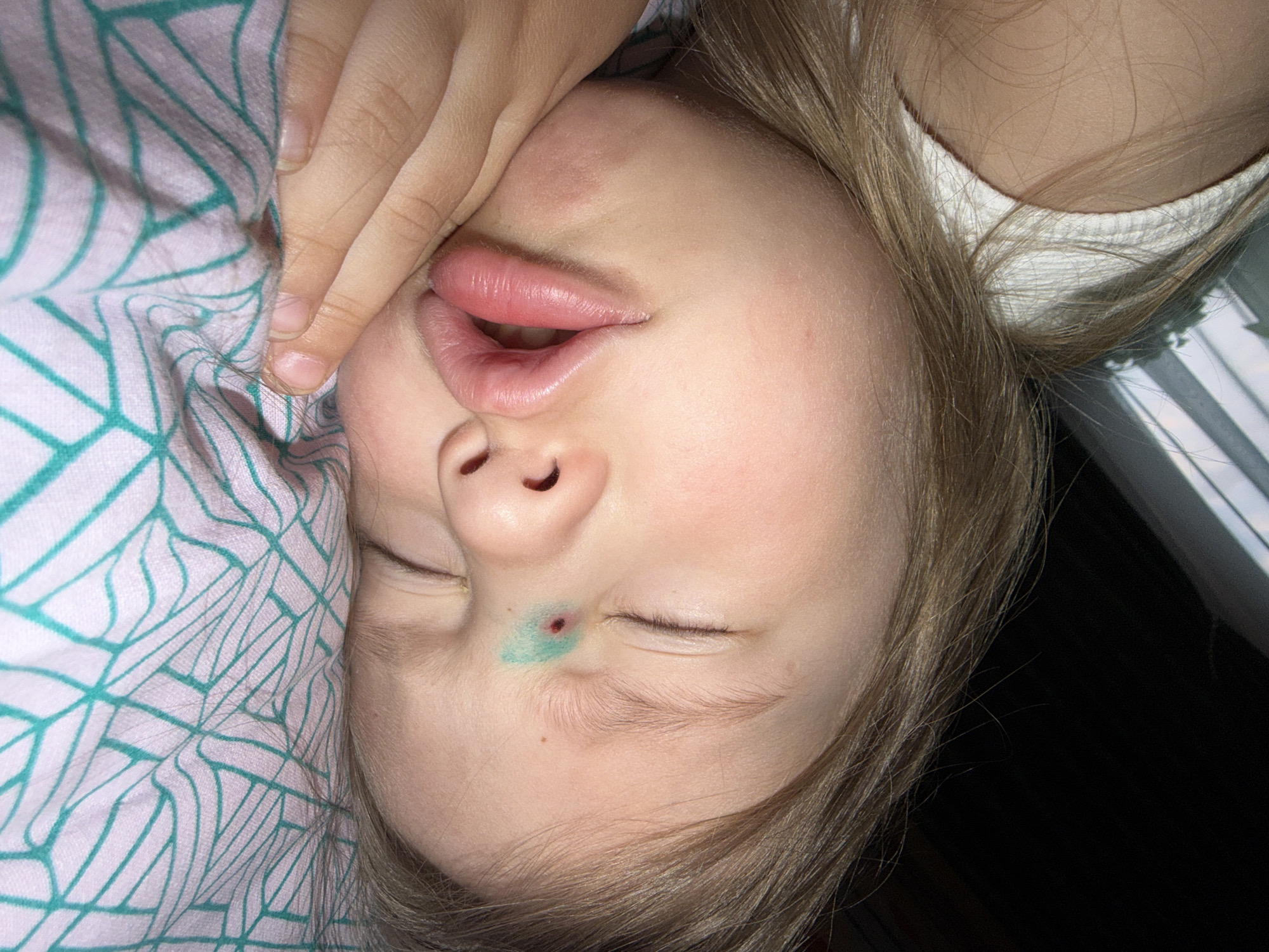 A sleeping child lies on a patterned blanket. The child's face is visible, showing closed eyes, an open mouth, and a mark near one eye. A hand is near the child's face. The image's location in the city of Chaikovsky, Russia, cannot be determined from the visual information provided.