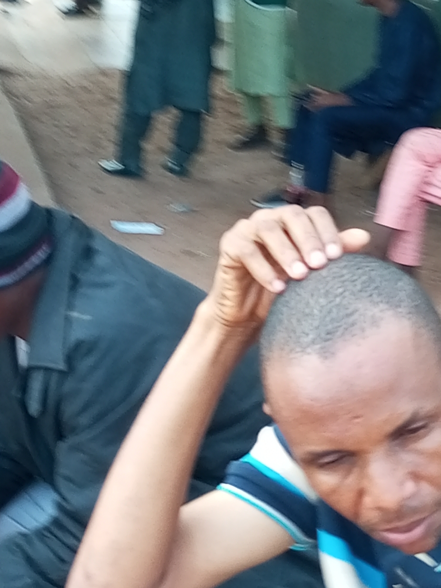 The image shows a close-up of a man's head and shoulder in the foreground. He has short, dark hair and is wearing a dark blue and white striped shirt. His hand is visible reaching up to touch his head. In the background, several other people are visible, some standing and some seated. They are wearing traditional African clothing, including a long, dark blue robe and a light green garment. The ground appears to be dirt or sand. The lighting suggests it is daytime, possibly outdoors. The overall impression is a casual gathering of people. There is no visible text in the image. The context suggests the location is Gombe, Nigeria.