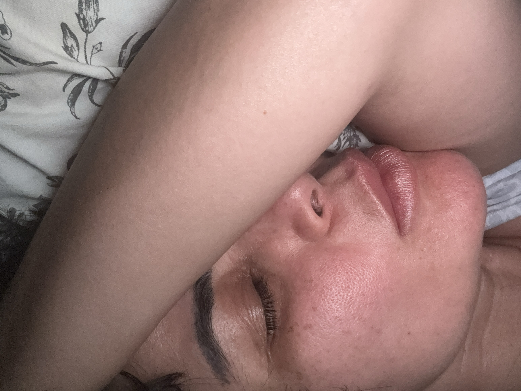 A close-up, overhead shot shows a person's face partially covered by their arm. The person's eyes are closed, and their lips are slightly parted. Their skin is flushed, with some visible pores and freckles. The arm covering the face appears to be smooth and unblemished. The background consists of a floral patterned sheet. The image appears to be taken in a bedroom in Bellmore, United States of America.