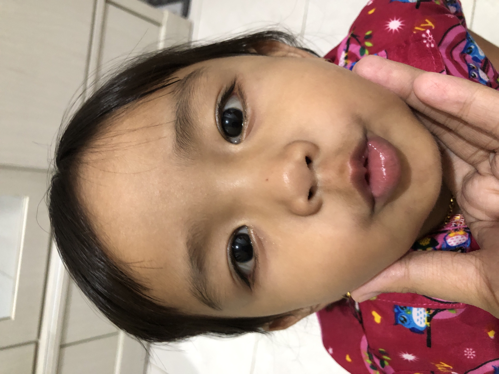 The image shows a close-up, from a low angle, of a young girl's face. Her eyes are wide open, and her lips are pursed. She is wearing a red shirt with an owl pattern. An adult's hand is supporting her chin and jaw. The background is a plain wall with horizontal paneling. The image was taken in Pashiebeutong, Indonesia.