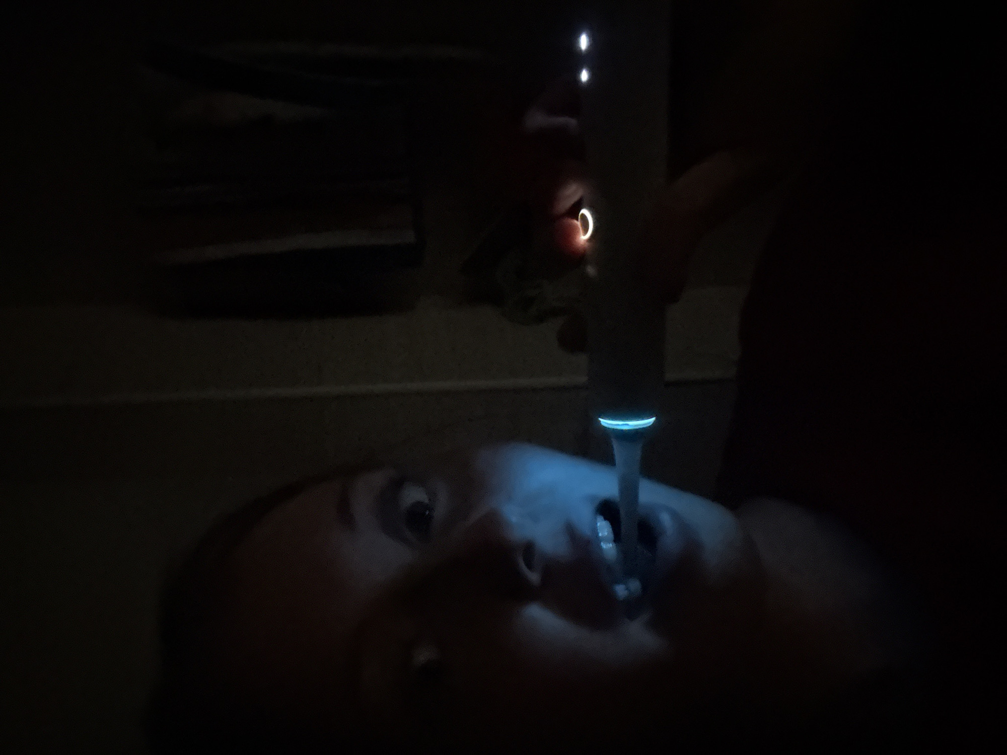 A person is lying on their back with their mouth open. A handheld device with a blue light is directed into the open mouth. The person's eyes are wide and focused. A hand is holding the device. The location is a dark, indoor space, possibly a bedroom. In the background, an object partially obscured by darkness. The city and specific location are unknown.