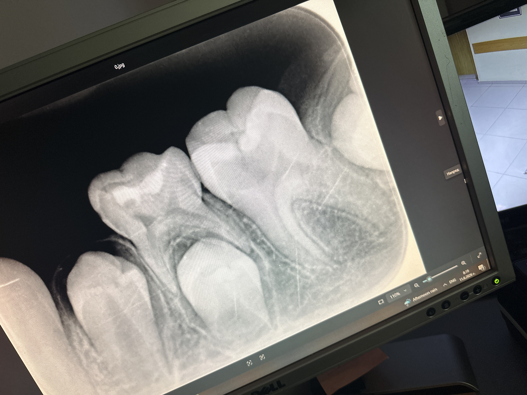 An X-ray of teeth is displayed on a computer monitor. The X-ray shows several teeth with some opaque areas indicating fillings or other dental work. The monitor is positioned at an angle, and a portion of a room with tiled flooring and a wall with a horizontal yellow stripe is visible in the background, suggesting a medical or dental office setting. The bottom right corner of the monitor displays system information including the date "11.6.2026", time "8:19", and language "ENG". The image shows no people, actions, or interactions. The location of Varna, Bulgaria, is not discernible from the visual information in the image.