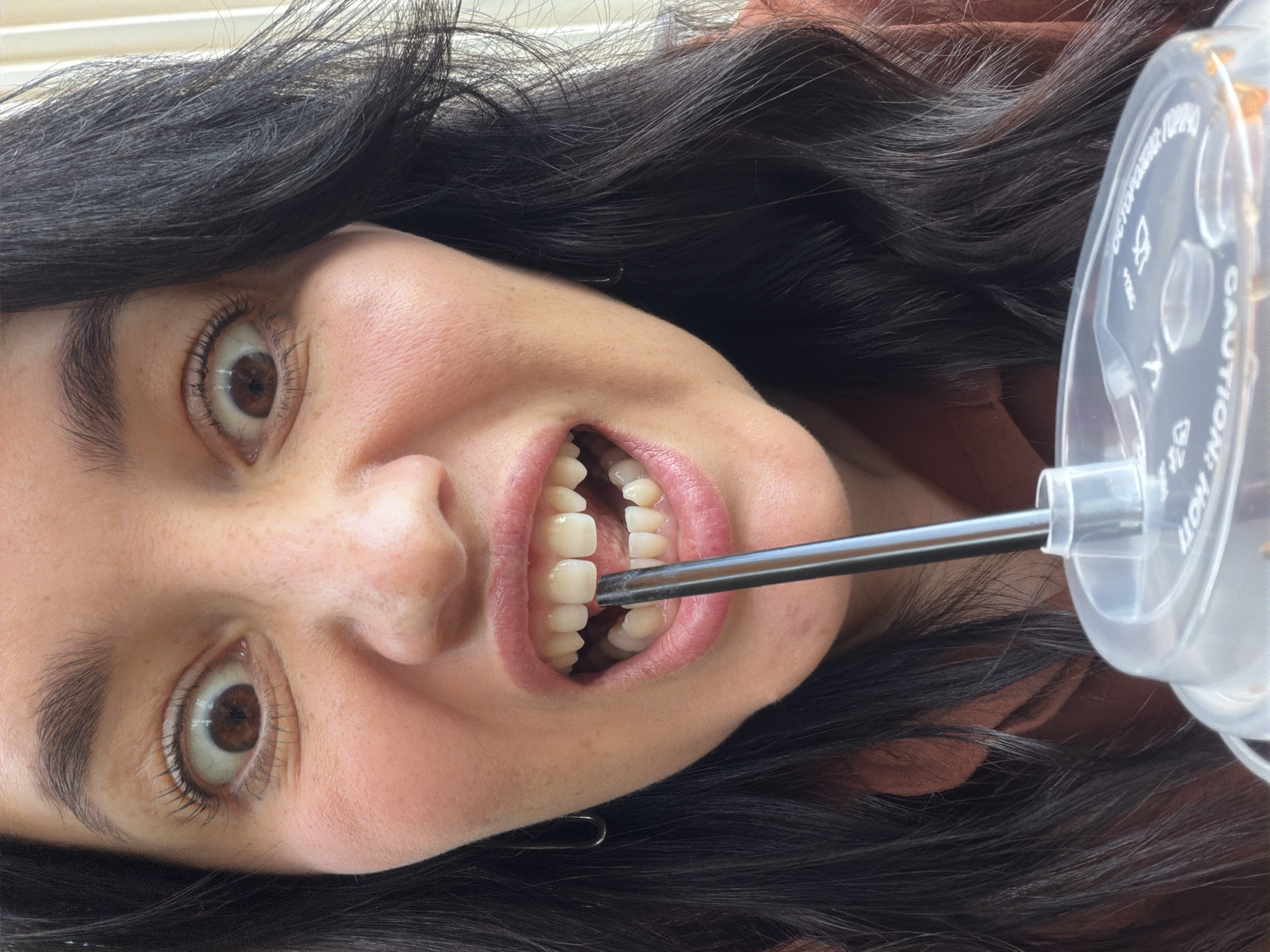 The media file shows a close-up, sideways, and upside-down view of a person's face and part of a plastic cup. The person has dark hair and brown eyes, and their mouth is open. A thin, metallic object, possibly a straw or a tool, is inserted into their mouth, touching their teeth. The plastic cup has text printed on it, which is partially visible and appears to be in English. Some of the legible words include "CAUTION" and "HOT," suggesting it might be a disposable beverage cup. The lighting suggests an indoor setting, possibly daytime. The expression on the person's face is difficult to ascertain due to the unusual camera angle and the object in their mouth, but their eyes are wide open. The background is out of focus, but some blinds are visible, hinting at a window. The provided location context of Moscow, Russia, does not offer any direct visual cues within the image itself.