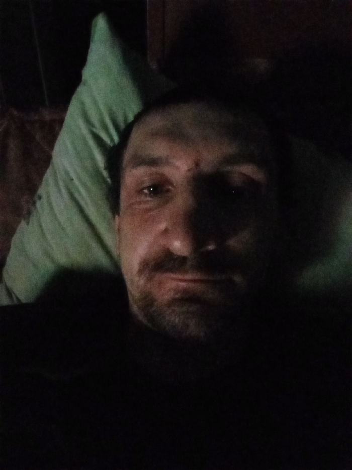The image displays an adult male in a dimly lit indoor setting in Yarun, Ukraine. The subject is positioned horizontally, resting his head on a light green pillow visible on the upper left. He has dark hair, a dark beard, and a mustache. The left side of his face and his left eye are more illuminated, revealing a small mark on his forehead above his left eyebrow. He is looking directly at the camera. Dark fabric is visible around his neck and upper chest. The background behind the subject and pillow is largely dark and indistinct.
