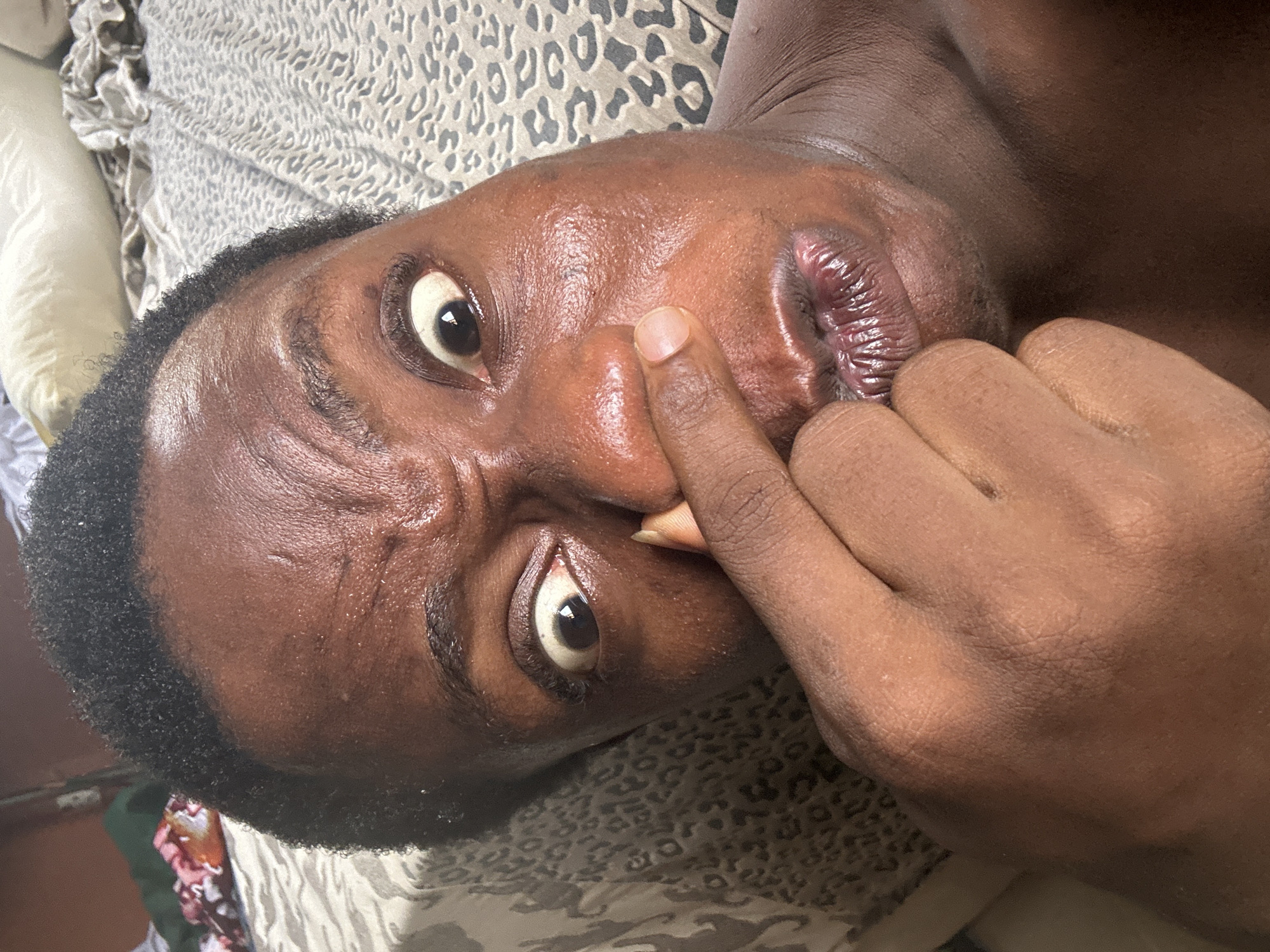 A close-up, angled shot depicts a person with dark skin lying on patterned bedding. The person is looking upwards with wide eyes and a furrowed brow. One hand is raised to their face, with a finger touching the side of their nose. The setting appears to be indoors, possibly a bedroom, but the specific location in Unknown, Unknown, is not discernible from the image.
