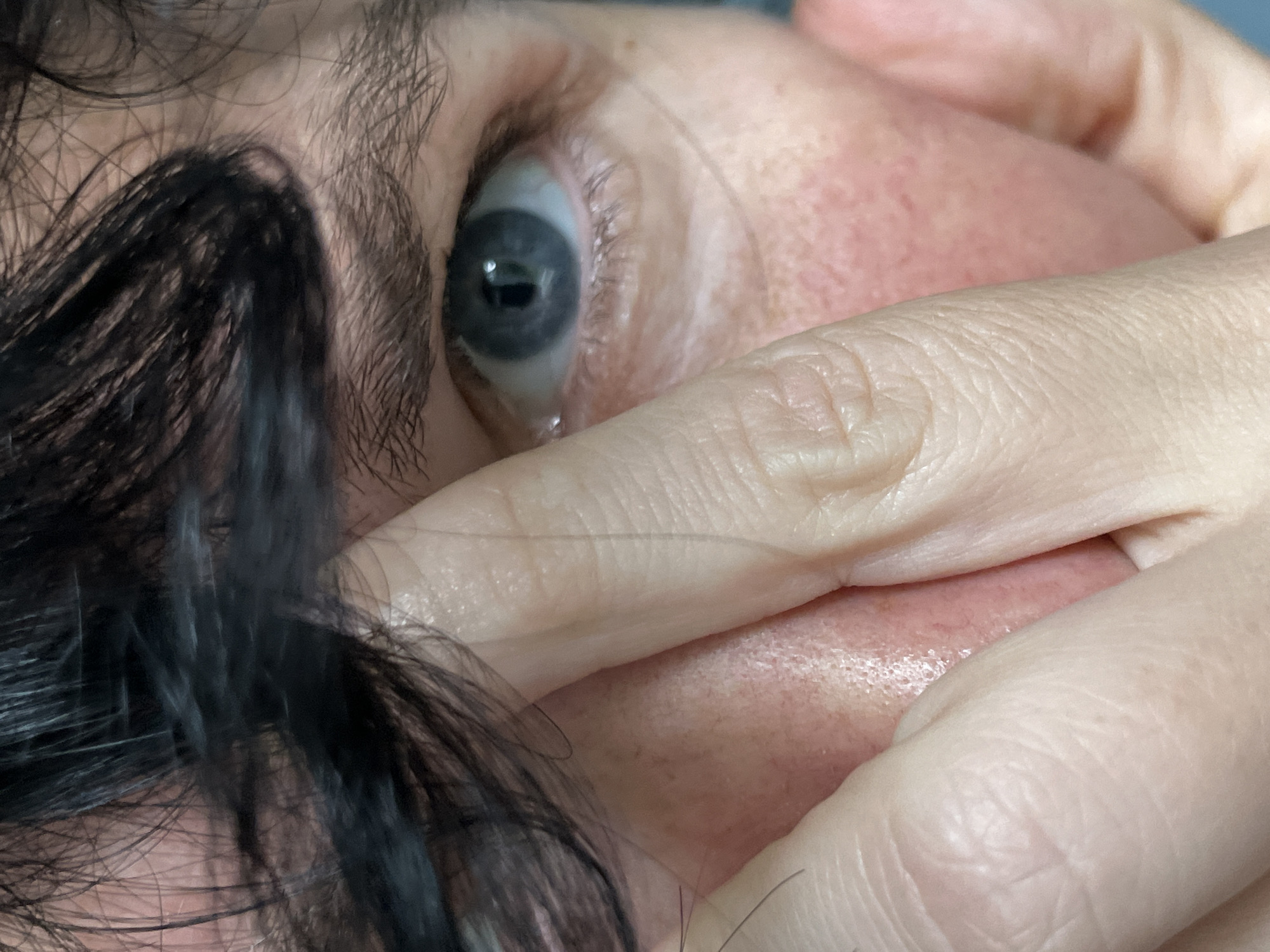 A close-up shot shows a person's eye and fingers. The eye is blue with a pupil visible. Fingers are in the foreground, obscuring part of the face. The skin appears to have some redness. The background is out of focus, showing dark hair. The location is listed as ღრმაღელის თემი, Georgia, but this information is not visually discernible from the image itself.