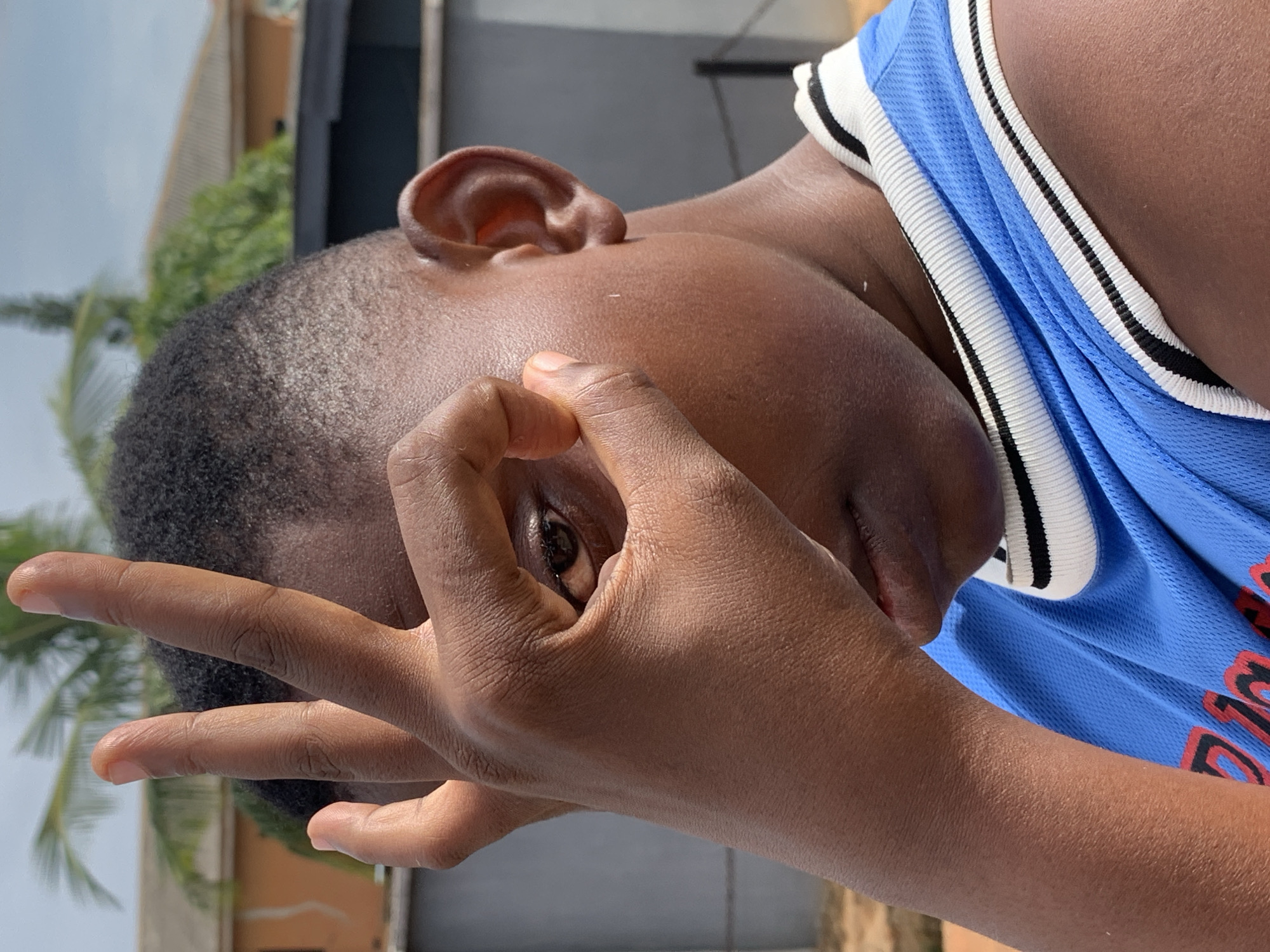 A close-up shot reveals a young person with dark skin and short black hair. They are wearing a blue and white athletic jersey. The person's right hand is positioned in front of their face, partially obscuring their features. One eye is visible through a gap in their fingers. The background is blurred, but shows hints of buildings and trees. Given the prompt location, the image was likely taken in Ikorodu, Nigeria, though no specific landmarks are visible to confirm this. The subject seems to be interacting with the camera by positioning their hand.