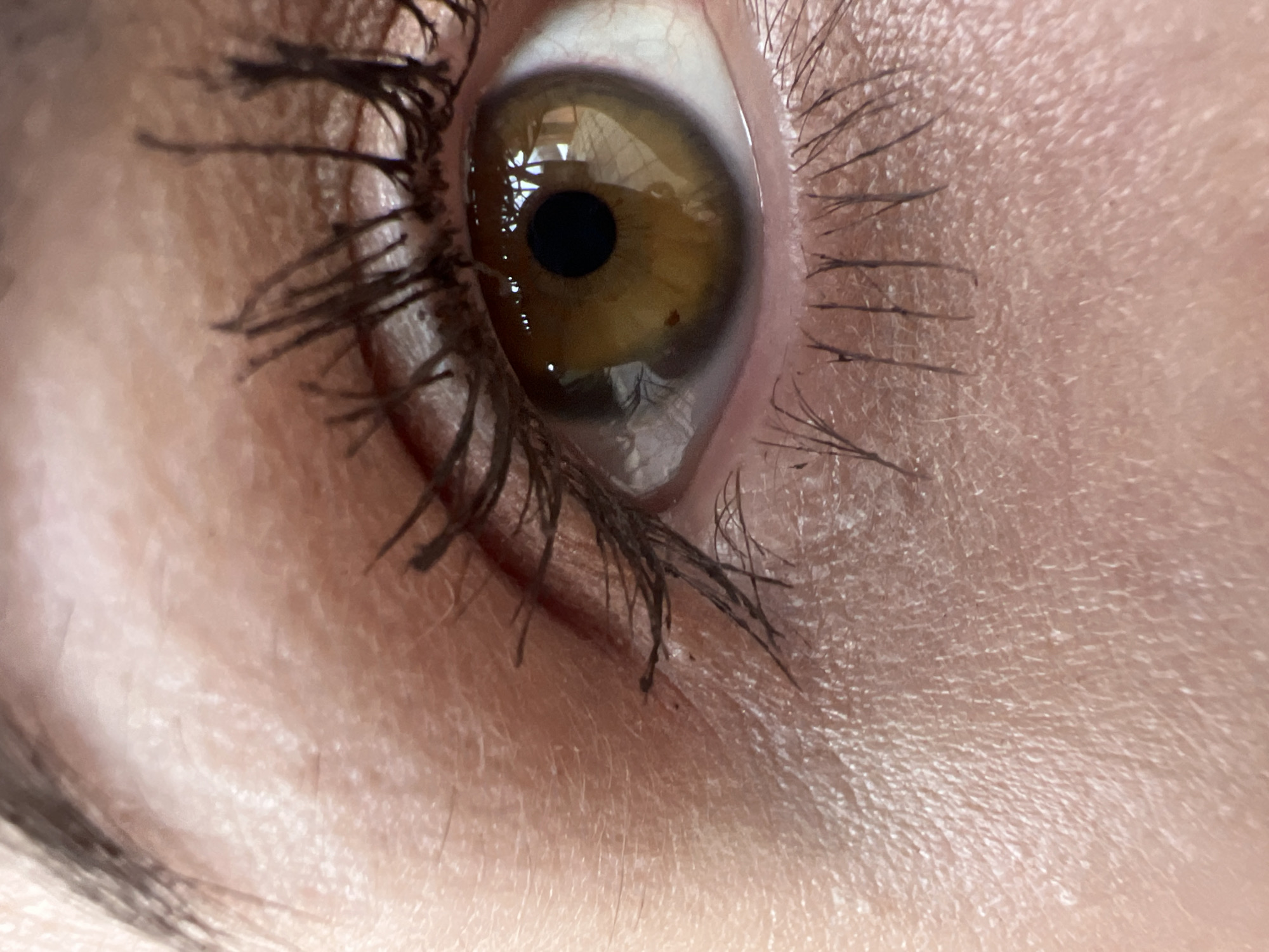 A close-up view of a human eye. The iris appears to be a shade of amber or hazel, with a dark pupil in the center. A small brown spot is also visible within the iris. Eyelashes coated with mascara frame the eye. The surrounding skin texture is visible, showing details of the skin and fine hairs. The image does not suggest a location within the city of Votkinsk, Russia.