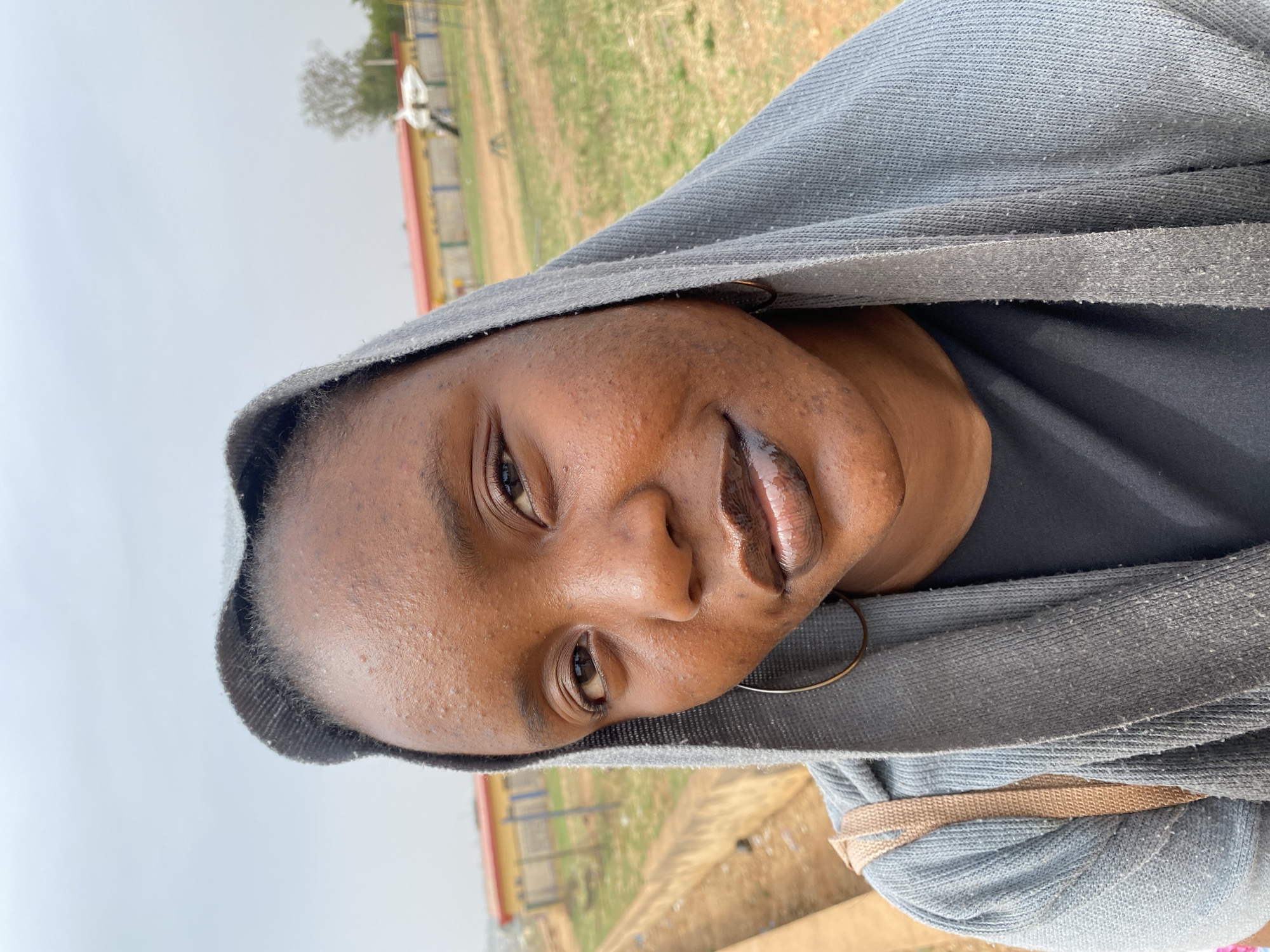 A close-up outdoor portrait features a person, likely a young female, with dark skin, looking directly at the camera with a soft, slight smile. Her full lips appear glossy, and a large, thin metallic hoop earring is visible on her right ear. Her skin shows natural texture with visible pores and some small bumps, particularly on her forehead and cheek.
She is wearing a gray hooded top, possibly a hoodie or cardigan, over a dark (likely black) top. The gray fabric has a knitted texture and shows some visible lint or small fibers. A tan-colored strap, possibly from a bag, is seen over her left shoulder/arm area.
The background, which is largely out of focus, shows an outdoor setting in Zawan, Nigeria. It features an open area with sparse green grass and dirt patches. In the mid-ground, there's a barrier or fence with red and other colored sections. Further back, a blurry tree and a light-colored structure are visible under a light, overcast sky, indicating it is daytime without direct sunlight. The overall impression is a casual, friendly outdoor moment. There is no visible text in the image.