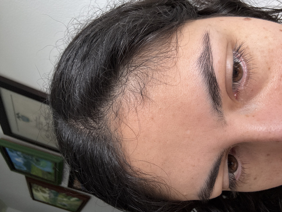 The image displays the upper facial region of an individual in an indoor setting within AMCO, Area Metropolitana Centro Occidente, Colombia. The subject exhibits dark, straight hair, parted centrally, with fine, loose strands visible along the hairline and forehead. The skin tone is light to medium, featuring scattered freckles or small moles across the forehead and periorbital areas. Dark brown eyes are directed downwards. Eyebrows are dark and appear full and well-defined. The background consists of a plain white wall upon which three framed items are mounted. From left to right, these include a dark-framed image, a green-framed image containing a landscape, and a dark-framed document, possibly a certificate, displaying text and a crest. No other individuals, objects, or actions are discernible within the frame. The lighting suggests an ambient, possibly natural, source.