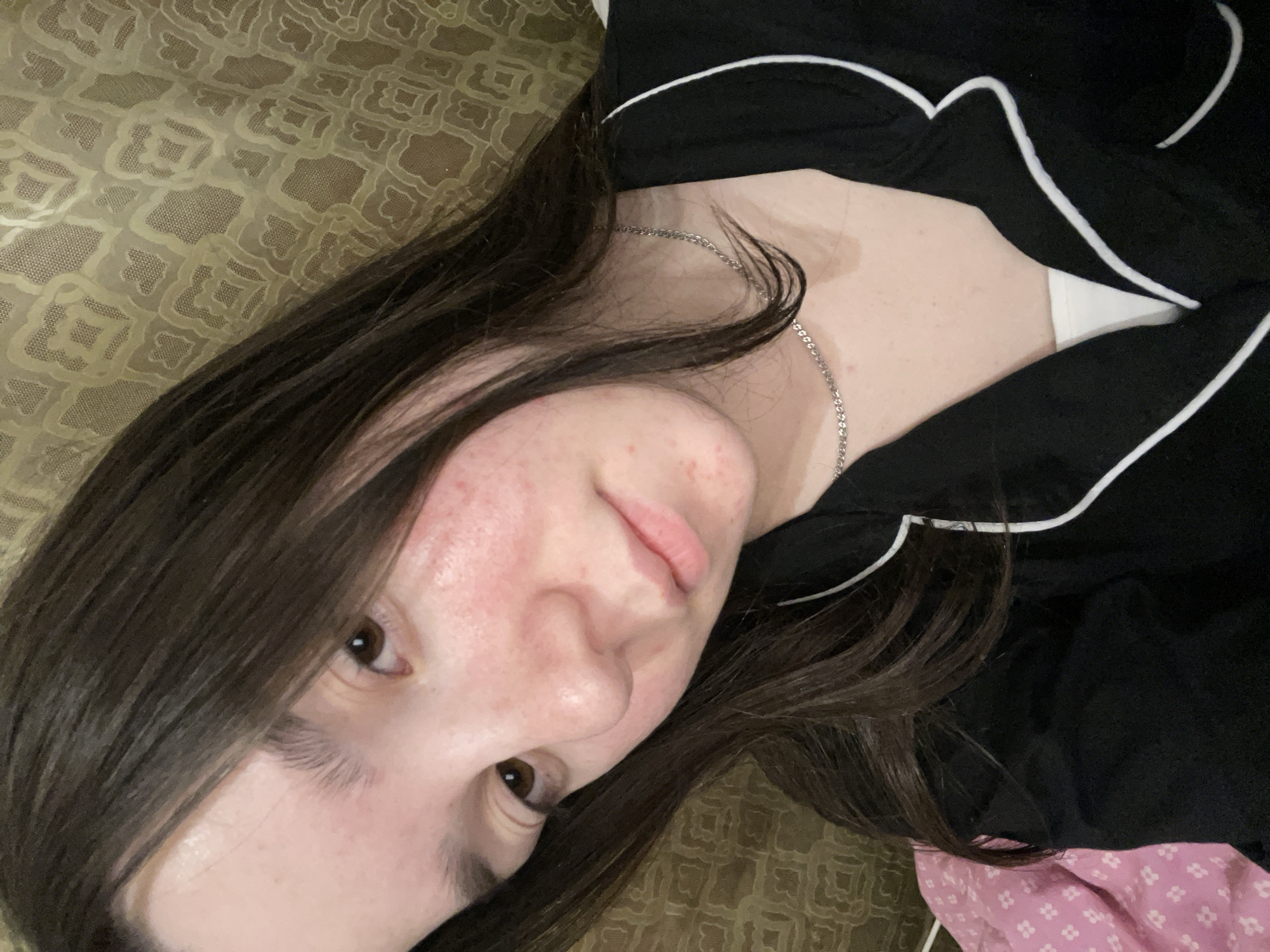 An indoor, close-up, self-portrait photograph captures a young female in the city of Ольховка, Russia. The subject has long, dark brown hair that falls across her right shoulder and forehead. Her skin tone is fair, with noticeable redness and scattered blemishes across her forehead, cheeks, and nose. Her eyes are dark brown, and her lips are light pink. She is wearing a black collared top, consistent with pajama wear, featuring white piping along the collar and front opening, with a white undershirt visible beneath. A thin, silver-colored chain necklace is worn around her neck. The background immediately to her left consists of pink fabric with a repeating pattern of small white four-petal flowers, indicating bedding. To her right and behind her head, a light brown or beige textured fabric, possibly a curtain or upholstery, displays an intricate, repeating geometric pattern. The subject is positioned with her head slightly tilted, gazing downward and to the viewer's left.