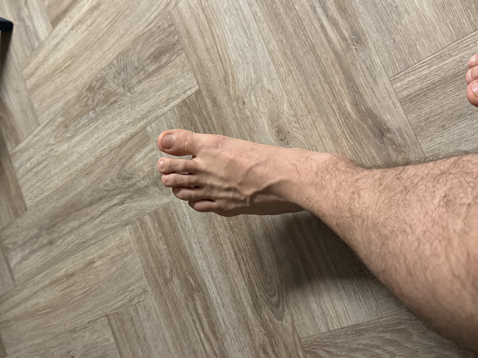 A person's hairy leg and foot are seen against a herringbone pattern floor. The foot is pale with visible veins. The toenails are neatly trimmed. The leg hair is dense and covers the lower leg. The floor is made up of light brown planks with a wood-like grain pattern arranged in a herringbone design. A small black object is partially visible in the upper left corner. Another part of a foot is partially visible in the upper right.