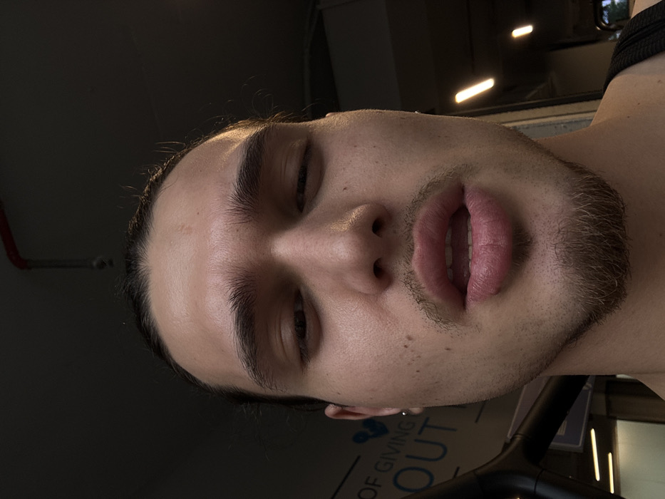 A close-up, low-angle portrait captures a young adult male. He has slicked-back dark hair, dark, thick eyebrows, and prominent full lips slightly parted, revealing upper teeth. Faint facial hair consisting of a mustache, soul patch, and goatee is present. Several scattered moles or freckles are visible on his cheeks. A small, silver hoop earring is worn in his left earlobe. He is wearing a dark, possibly ribbed, tank top. The background on the left features a blurred white sign with blue text reading "OF GIVING" and "OUT," alongside a blue heart graphic, identifying the location as the Mall of Sofia in Sofia, Bulgaria. On the right, two distinct vertical strip light fixtures are visible against a dark background. A red pipe or conduit is affixed to the dark ceiling overhead.