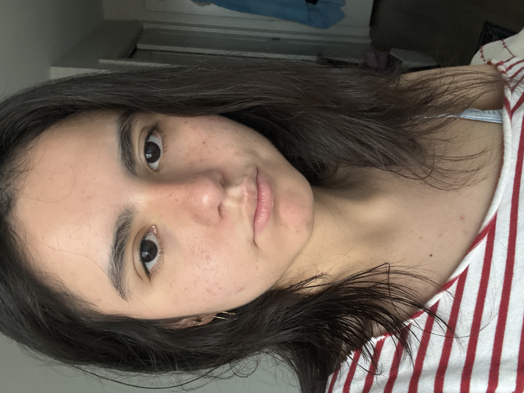 A woman with dark hair and brown eyes is looking at the camera. She is wearing a red and white striped shirt and what appears to be a blue bra strap is visible. The background is a neutral color, likely a wall. There is a door in the background that has a blue towel hung on it. The woman has some blemishes on her face. The photo appears to be taken indoors, possibly in a bedroom. The location is unknown.