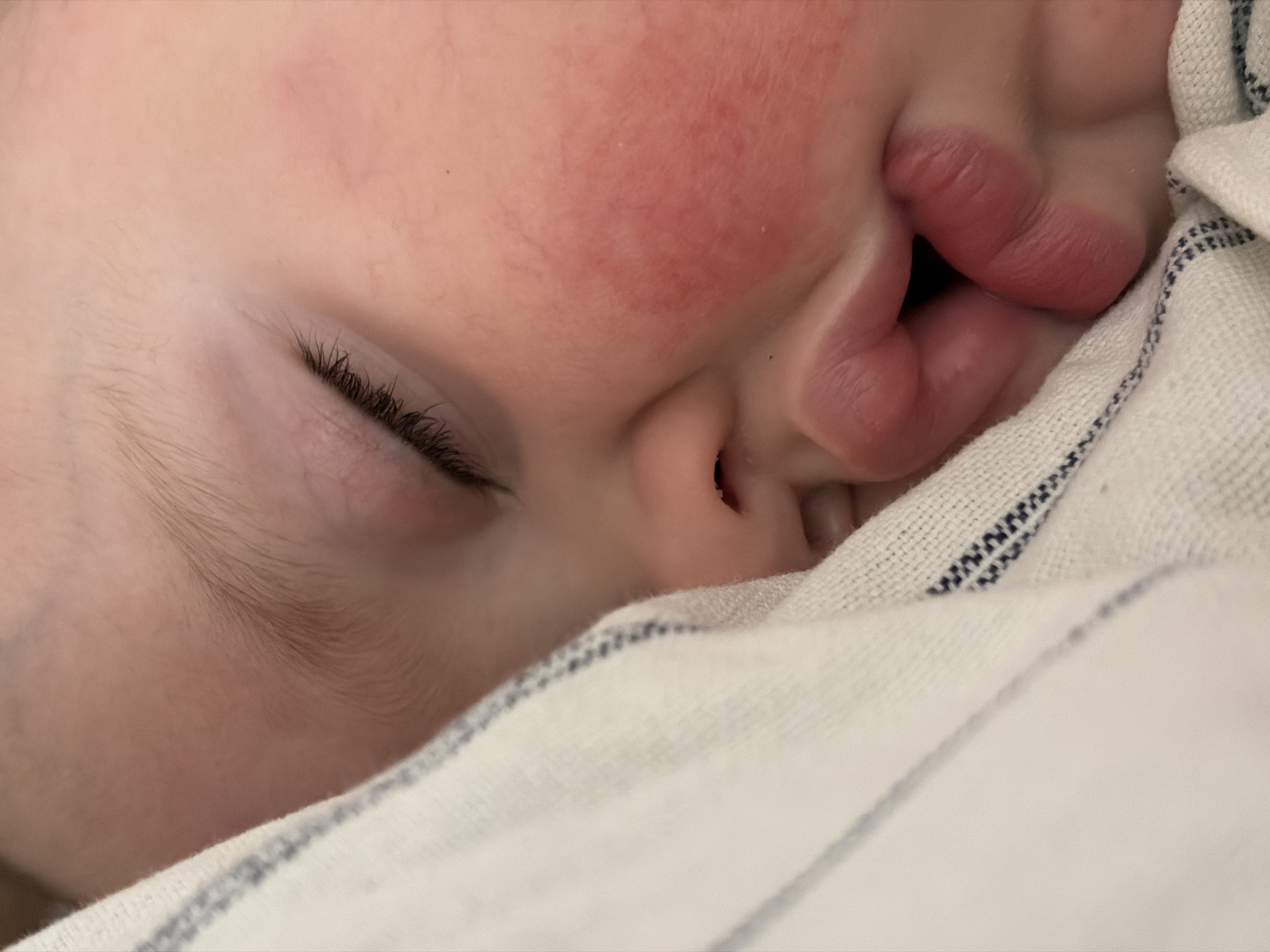 The scene depicts a close-up of a sleeping infant's face, located in the city of Chaikovsky, Russia. The baby lies on its right side, partially enveloped by a light-colored fabric. The right eye is closed, with visible dark eyelashes. Fine, light-colored hair is present on the scalp. The fair skin of the right cheek exhibits a pronounced reddish flush and minor surface irregularities. The small nose is visible, and the full, pink lips are slightly open, appearing relaxed or softly puckered. The enveloping fabric, possibly a blanket, is off-white with a visible woven texture and features a border of dark blue, dashed stitching along its edge, against which the baby's face is nestled. The overall impression is one of undisturbed rest.