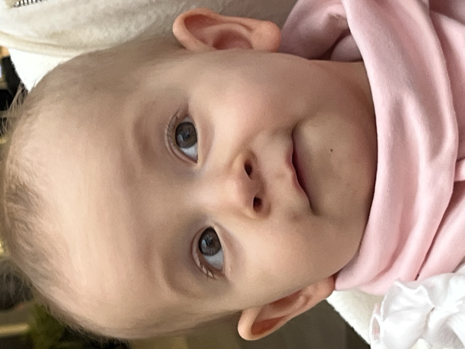 The image displays a close-up portrait of an infant, estimated to be between six months and one year old. The infant possesses fair skin, sparse light-colored hair, and prominent dark brown eyes directed upwards and slightly to the viewer's left. A small, dark mole is visible on the chin, situated below the left corner of the mouth. The infant is wearing a pink, high-collared garment. A white, ruffled fabric is partially visible on the lower left side of the frame, while a white, textured fabric, potentially a blanket or a piece of clothing, is visible on the right, suggesting the infant is being held or supported. The background is out of focus, indicating an indoor environment, but provides no discernible features for specific identification. The location in the city of Khimki, Russia, cannot be independently verified from the visual information presented in the image.