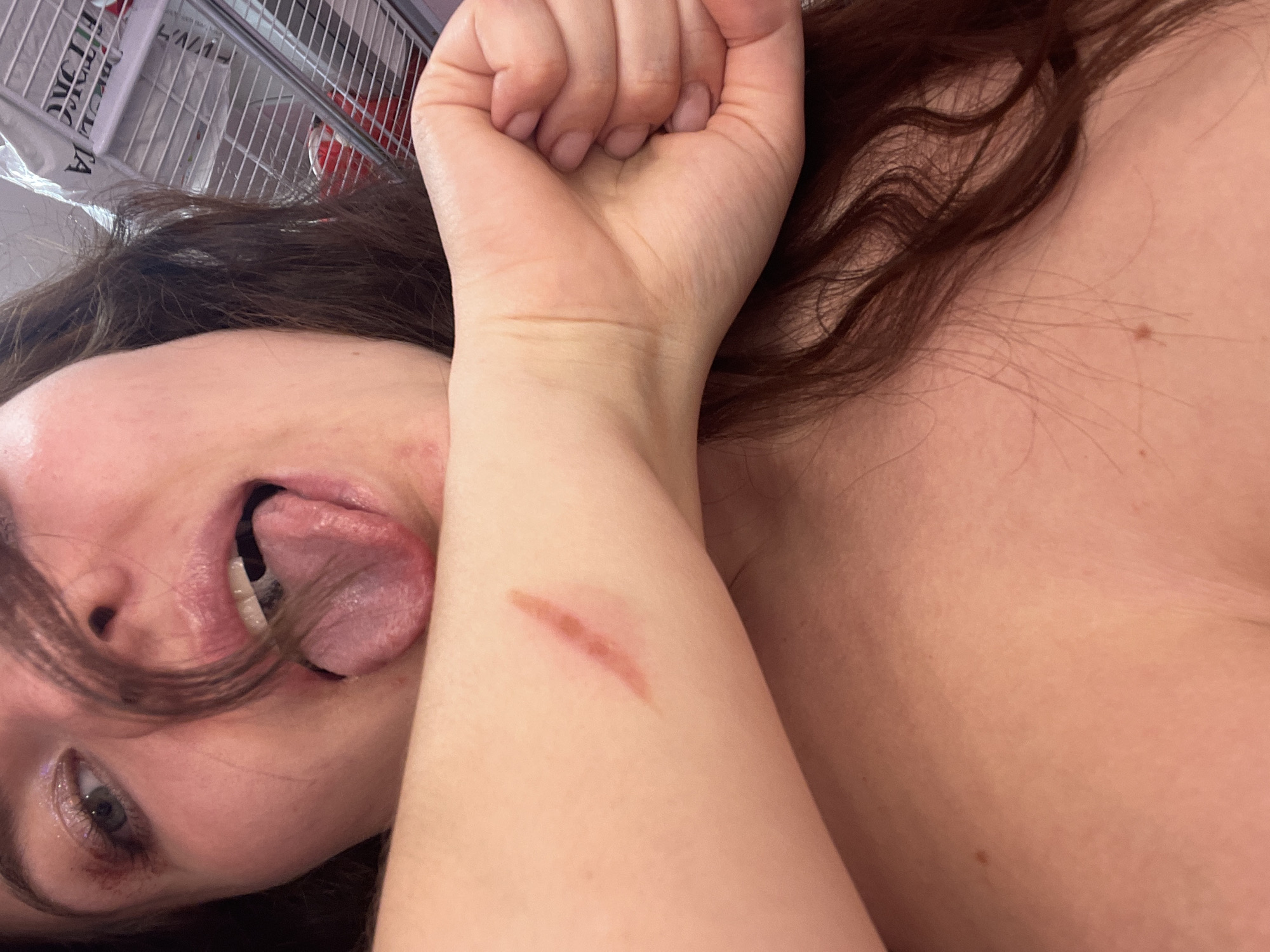 A person with brown hair is lying down and sticking out their tongue. Their left arm is raised, with a scar visible on the forearm. A shopping cart is visible in the background. The location, Мосметаллоконструкция Онт, Russia, is not discernible from the image.
