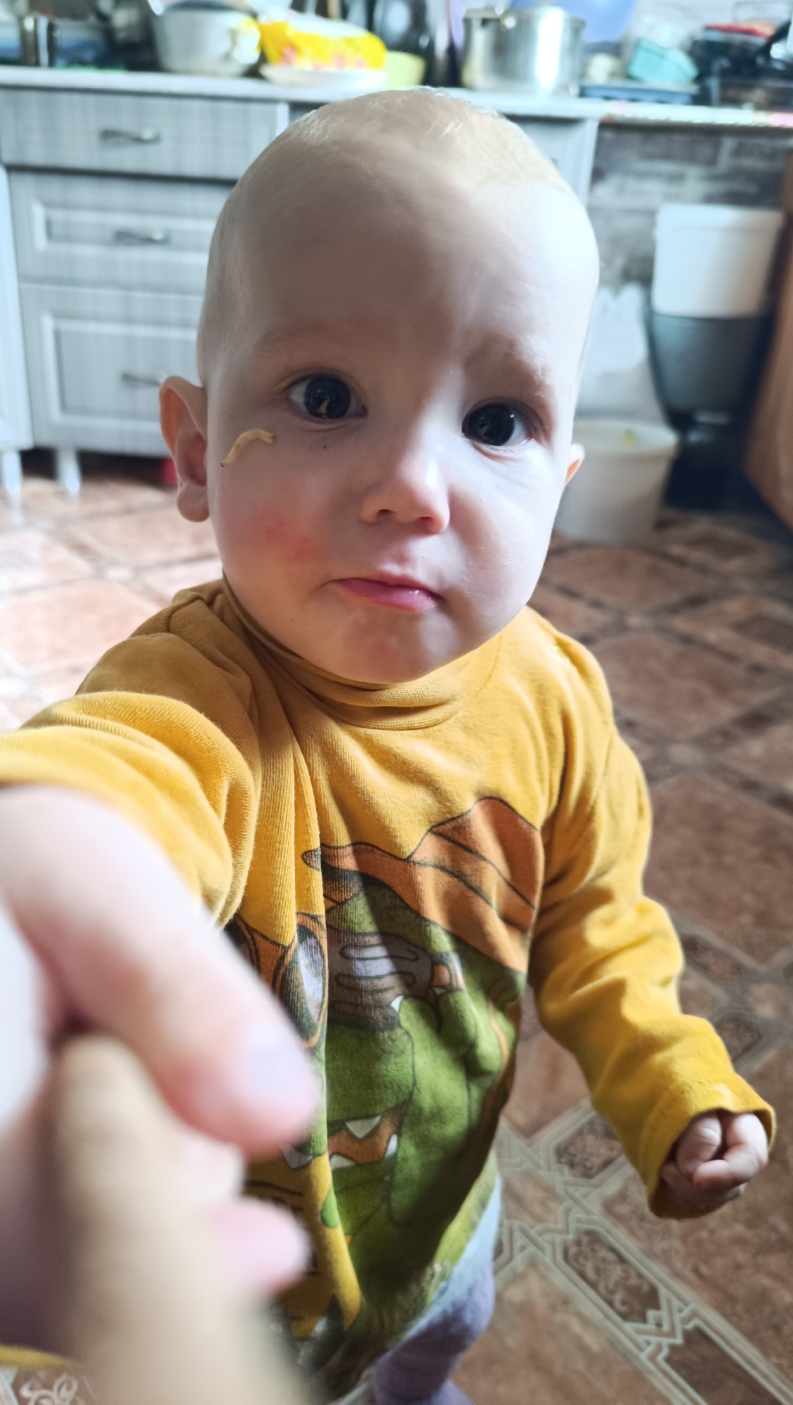 A close-up, waist-up, vertical, eye-level shot shows a Caucasian toddler with a bald head and light skin, looking directly at the camera. The toddler is wearing a yellow, long-sleeved, high-neck shirt with a graphic print of what appears to be a cartoon alligator or dinosaur. A thin, light-colored substance, possibly food or dirt, is visible on the toddler's right cheek, near the eye. The toddler's cheeks are slightly flushed red. Their lips are slightly parted, and their eyes are dark and wide. The background is out of focus and appears to be a kitchen or dining area with tiled flooring and cabinetry. The toddler's left hand is reaching towards the camera, partially obscuring the foreground. The image was taken indoors. No specific location in Karsha, Russia is identifiable from the visual cues.