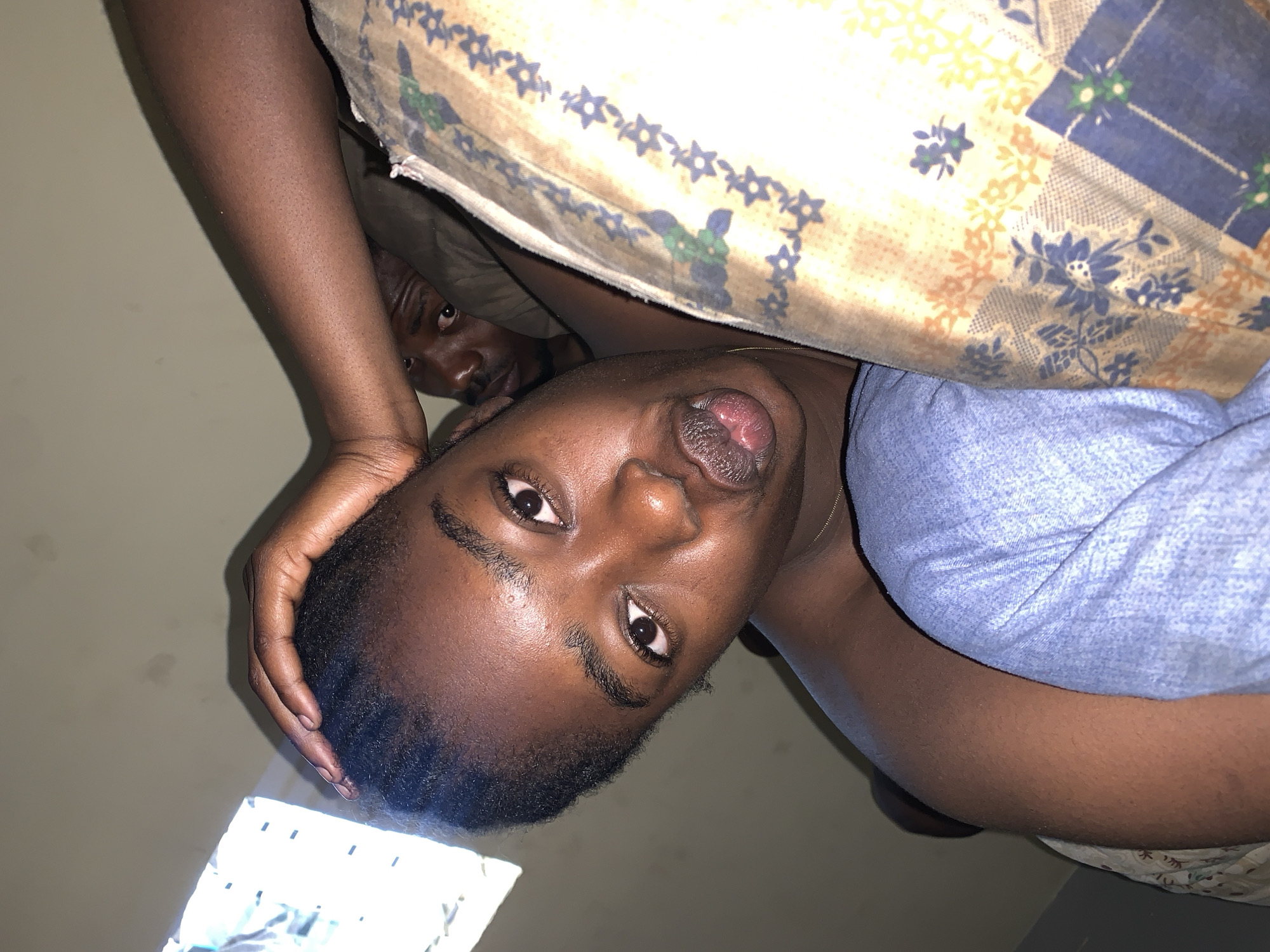 Two people are in the image. The person in the foreground is lying down and looking at the camera. Part of a patterned blanket is above them and an arm with dark skin is near the head. The second person is in the background, partly obscured by the blanket, and looking towards the left. The background appears to be a wall. The location is Rafin Par, Nigeria.