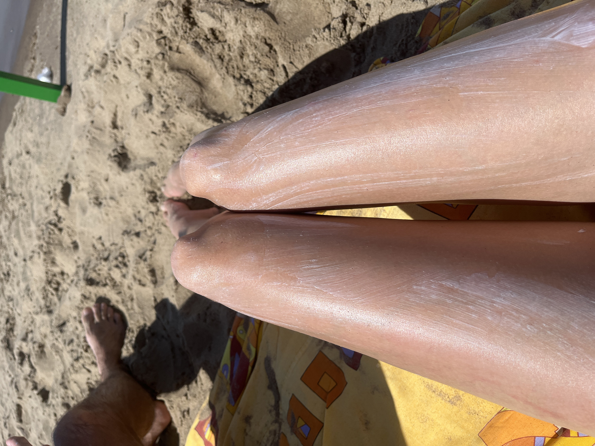 In Novokuybyshevsk, Russia, a close-up shot focuses on a person's legs covered in sunscreen, resting on a sandy beach. The legs are positioned diagonally, with the right leg slightly closer to the viewer. The skin is pale and appears to be lightly tanned, with a visible sheen from the sunscreen application. The sunscreen is white and applied unevenly, creating streaks and patches on the skin. The sandy environment is visible in the background, with footprints and some texture to the sand. To the left of the legs, a yellow towel with an orange and blue geometric pattern is partially visible. Further in the background, on the right side of the frame, a blurry green pole rises from the sand, and a small white object is near its base. To the left, the bare legs and feet of another person are visible, with tanned skin and dark hairs. The overall scene suggests a sunny day at the beach.