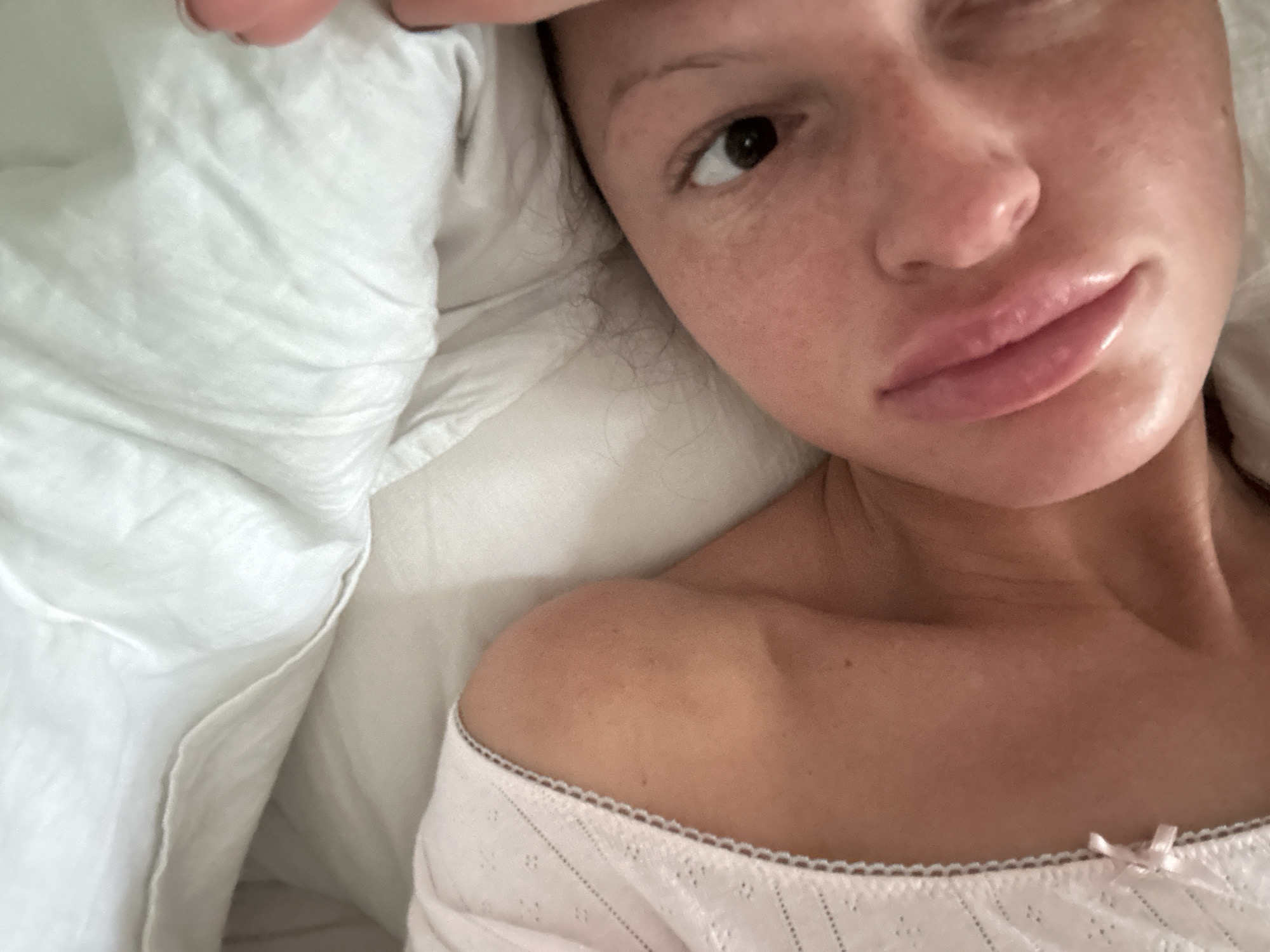 A close-up, selfie-style photograph features a person with fair skin, freckles, and full lips. They have one eye visible, which is brown. The person is lying on a white pillow, and a portion of their shoulder is visible, wearing a light pink top with a scalloped trim and a small bow detail. The environment appears to be indoors, likely in a bedroom setting. No specific details indicate the location is in the city of Wealden, United Kingdom. The image focuses on the person's face and upper body.