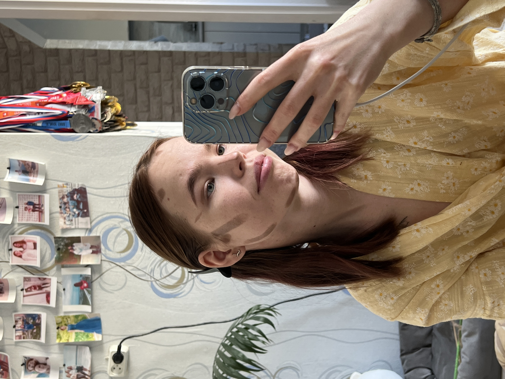 A young woman is taking a selfie using a smartphone in a case that has blue lines on it. She is wearing a yellow daisy-patterned dress and has brown hair with some reddish highlights. There are makeup contour lines on her face. She has a silver bracelet on her wrist and a gold earring shaped like a person jumping. The background shows a wall with a collection of pinned photos, an electrical outlet, a palm plant, a grey sofa, and wallpaper with a swirly pattern. There are medals hanging on a shelf above her. This is within the city of Chaikovsky, Russia.