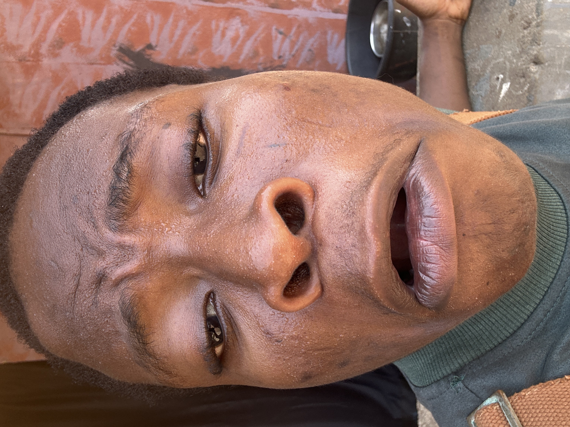 A close-up, slightly rotated view of a person's face with dark skin. The person has dark brown eyes, short black hair, and slightly open lips. Sweat glistens on their forehead and around the nose. Part of a green t-shirt and a brown strap with a metal buckle are visible on the lower right. The background includes a reddish-brown surface at the top and what appears to be a concrete surface on the right. The location is Unknown, Unknown.