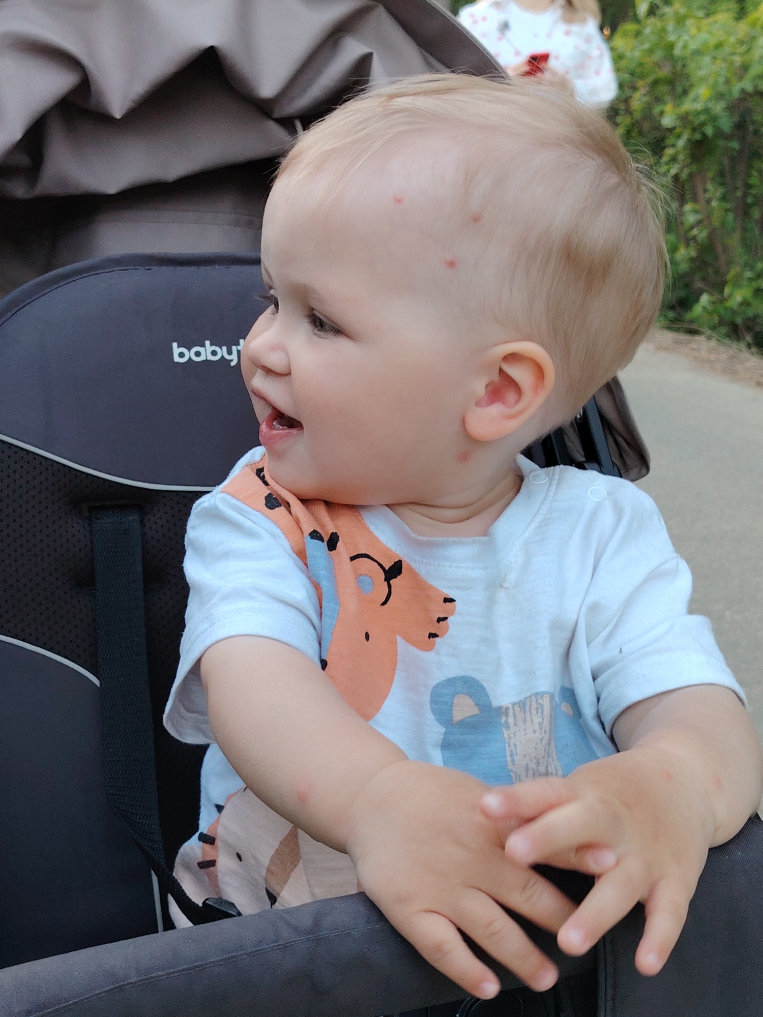 A fair-skinned baby with blond hair sits in a stroller. The baby has several small red marks on its head, ear, and arms, possibly insect bites. The baby is wearing a white t-shirt with a cartoon animal design. The stroller has a dark gray frame and a seat with the word "baby" printed on it. The background includes green foliage and a glimpse of a person wearing a white shirt. There is no evidence to suggest the location is Chaikovsky, Russia. The location is unspecified.