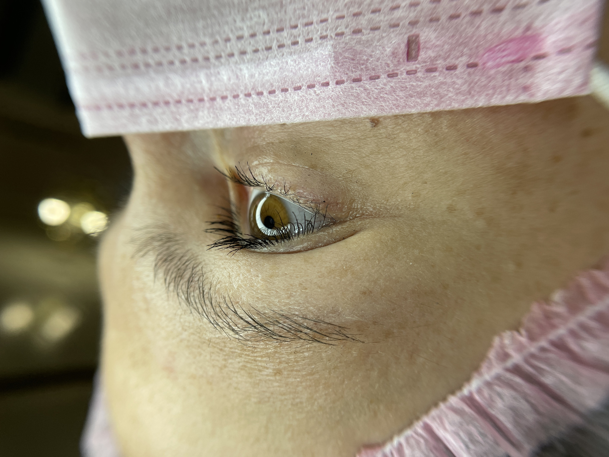 The image presents a close-up, side-profile view of a person's open eye, eyebrow, and surrounding skin. The eye features a dark brown iris and a visible pupil, reflecting a light source. Prominent, dark eyelashes are visible on both the upper and lower eyelids, appearing long and well-defined. A section of a dark eyebrow is also visible above the eye. The skin around the eye and on the forehead area exhibits fine lines and small, dark moles or freckles.
Partially covering the upper part of the forehead and hair is a pink, disposable, non-woven fabric head covering, likely a medical cap or headband used during a procedure. This covering displays a pattern of horizontal dashed lines, possibly indicating stitching or material texture, and has a slightly ruffled, elasticized edge along the bottom.
The background is dark and out-of-focus, featuring several blurred, circular lights, which suggests an indoor setting with artificial lighting. The overall scene implies a beauty treatment or medical procedure, given the close-up focus on the eye and the use of protective headwear.
No specific time of day or weather conditions can be determined from the image. The person's expression appears neutral, with no discernible emotion. There is no visible text in the media file. While provided as a general context, there are no specific visual cues within the image itself to indicate the location is Izhevsk, Russia.