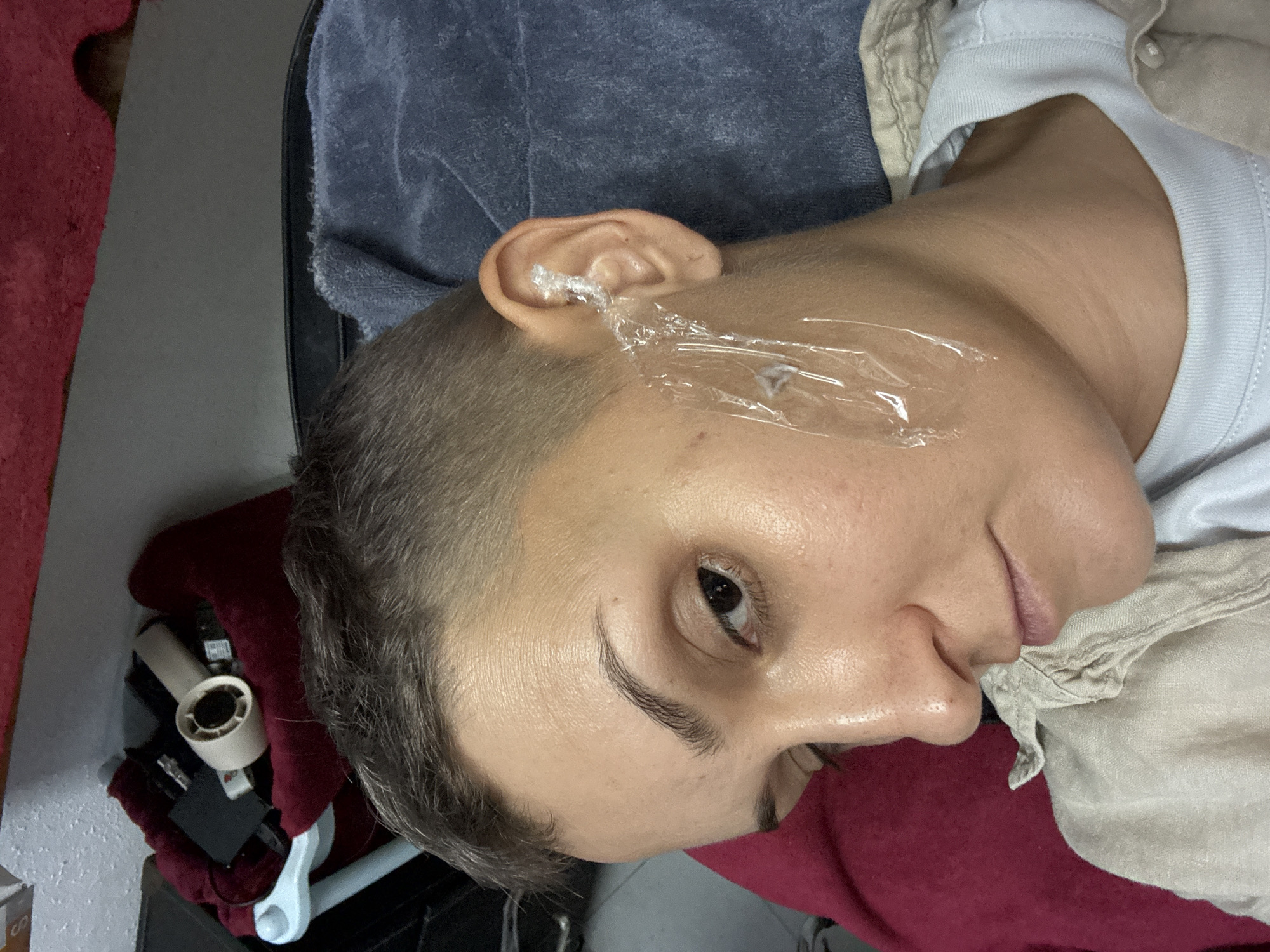 The media file shows a close-up, rotated view of a person's face, with a particular focus on their ear and temple area. The individual has short, dark hair and appears to be lying down. Their right ear is covered in a clear plastic wrap, which also extends to a portion of their temple and cheek. This suggests a medical or cosmetic procedure is being performed or has recently been completed. The person's skin appears fair and smooth.
The background includes a blue towel draped over something dark, and a red cloth to the left and bottom of the frame. In the lower left quadrant, an object that resembles a white tape dispenser or a similar tool is visible, partially covered by the red cloth.
The lighting is somewhat diffused, and there are no clear indicators of the time of day or weather conditions. The overall setting appears to be indoors, possibly in a salon, clinic, or home environment. The person's expression is neutral, with their eyes open, looking slightly upwards. There is no visible text in the media file. The context of Nha Trang Ward, Vietnam, does not provide specific visual cues within this close-up shot.