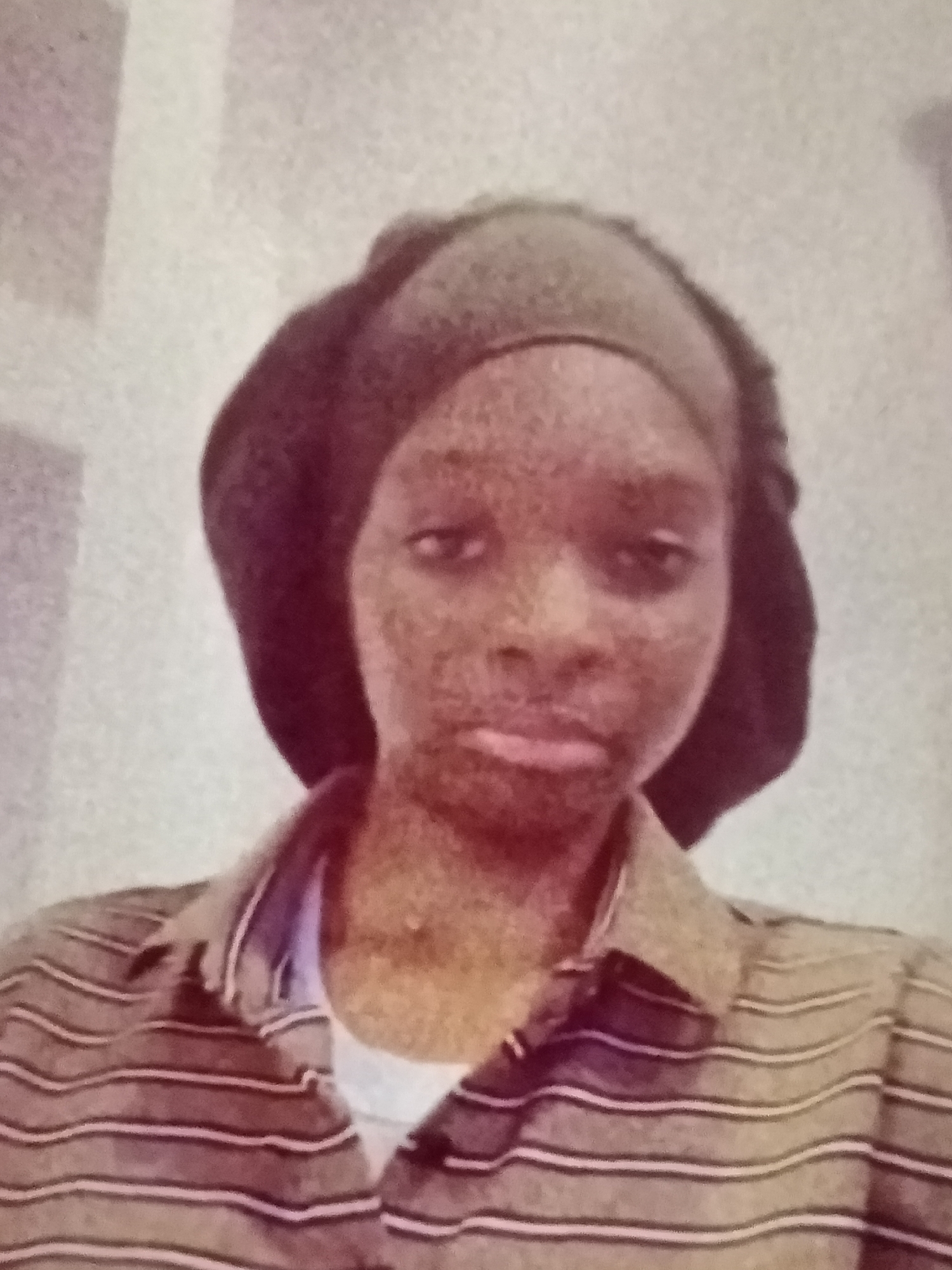The image is a medium shot, front-facing portrait of a young Black person wearing a dark head covering and a striped collared shirt. The background is a plain, light-colored wall. The person's facial expression is neutral. The image appears to have been taken indoors, likely in a residential setting. There are no discernible landmarks or environmental clues to suggest the location is Jalingo, Nigeria.