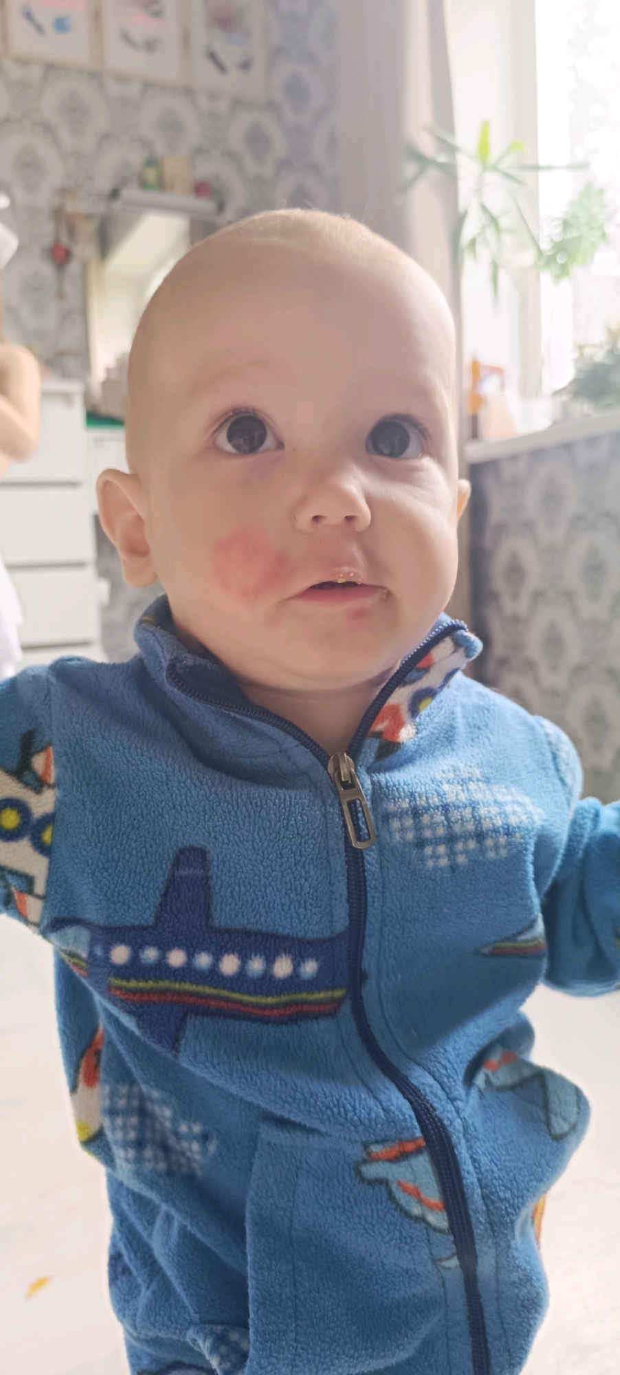 A young child, likely a toddler, is the subject of this close-up, head-and-shoulders portrait. The child is facing forward, with a slightly upward gaze. The child has fair hair and large, dark eyes. A noticeable red rash is visible on the child's left cheek, extending slightly towards the mouth. The child is wearing a blue fleece jacket with a zipper. The jacket features a colorful airplane graphic and a checkered pattern on the sleeves. The background is softly blurred, but appears to be an indoor domestic setting. The lighting suggests it is daytime, possibly with natural light coming from a window. The image quality is somewhat low, with a slightly grainy texture. The location of Chaikovsky, Russia, is not discernible from the visual information presented in the image.