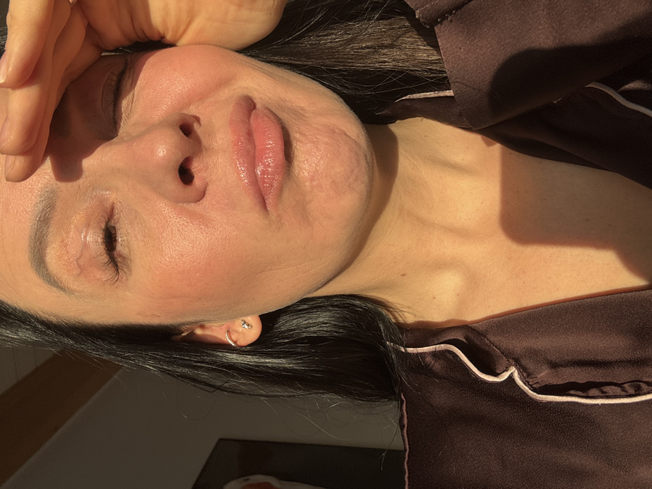 A woman reclines, partially shadowed, in soft, ambient light. Her skin is fair, with visible pores and subtle wrinkles. Her lips are glossy and slightly parted, while her eyes are closed. She wears a dark, silk-like pajama top trimmed with light pink piping. Her hand rests on her forehead. A small hoop earring is visible in her ear. Her dark hair is partially obscured by shadows.